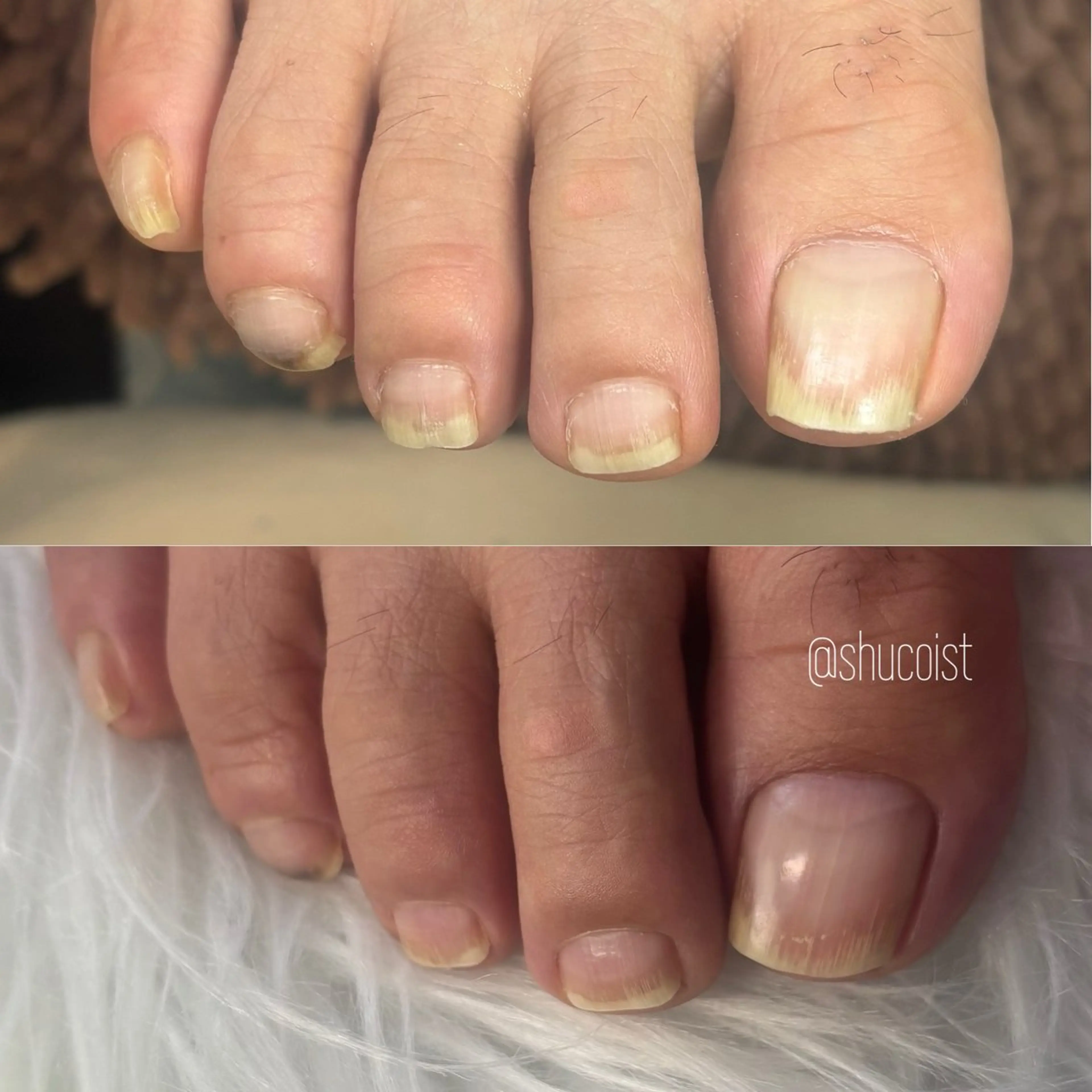 【メンズ限定】フットシャンプー付き🫧フットケア🦶【サンダル履く前に綺麗に✨】の写真