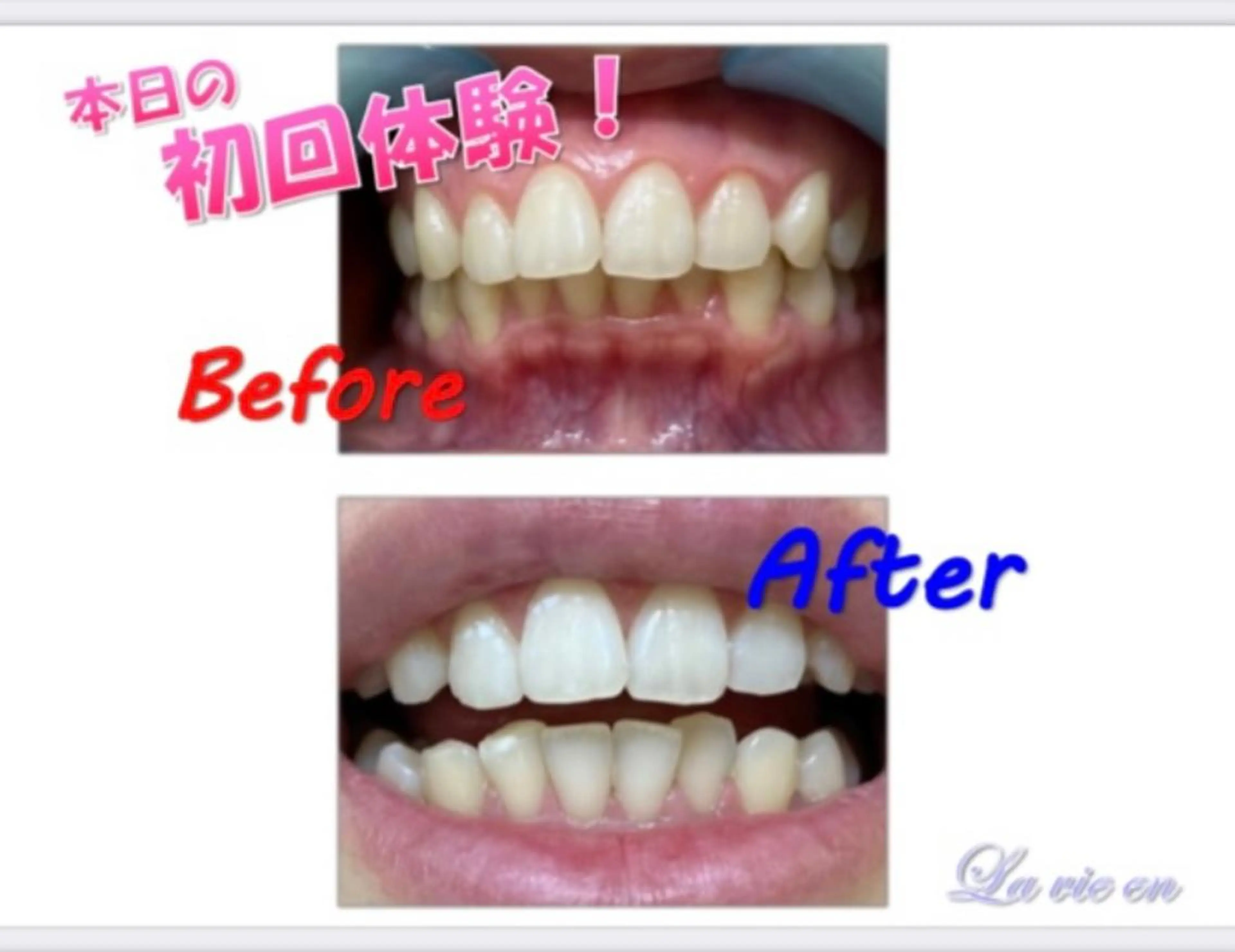 その他 セルフホワイトニングサロン　ラヴィアン所属・ホワイトニングサロン La vie enのその他イメージ