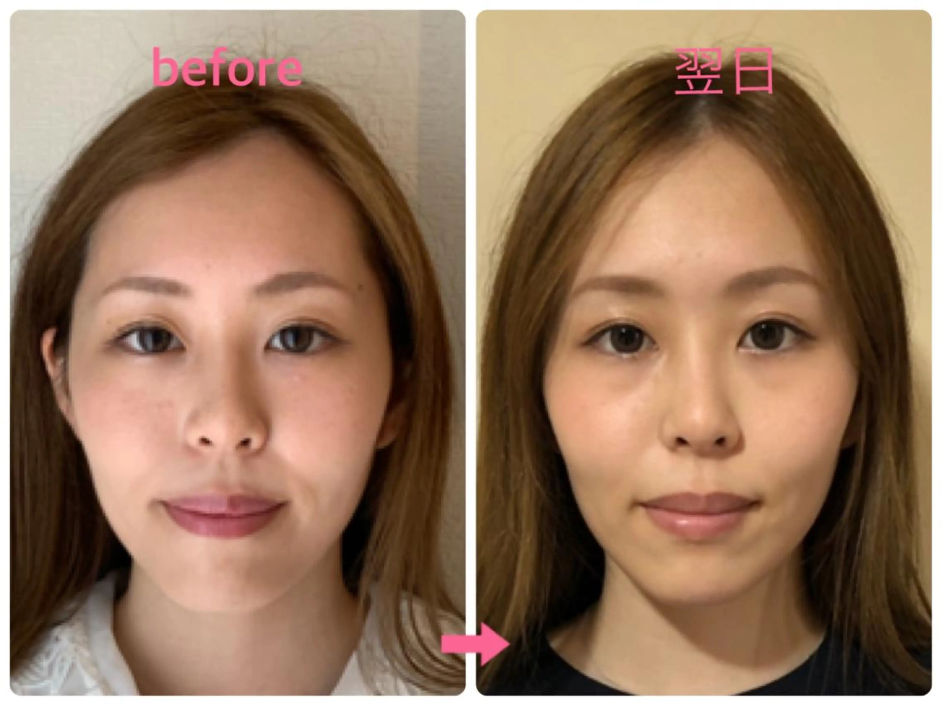 小顔美s.(ビズ)所属・小顔 美s.(ビズ)のエステ・リラクイメージ