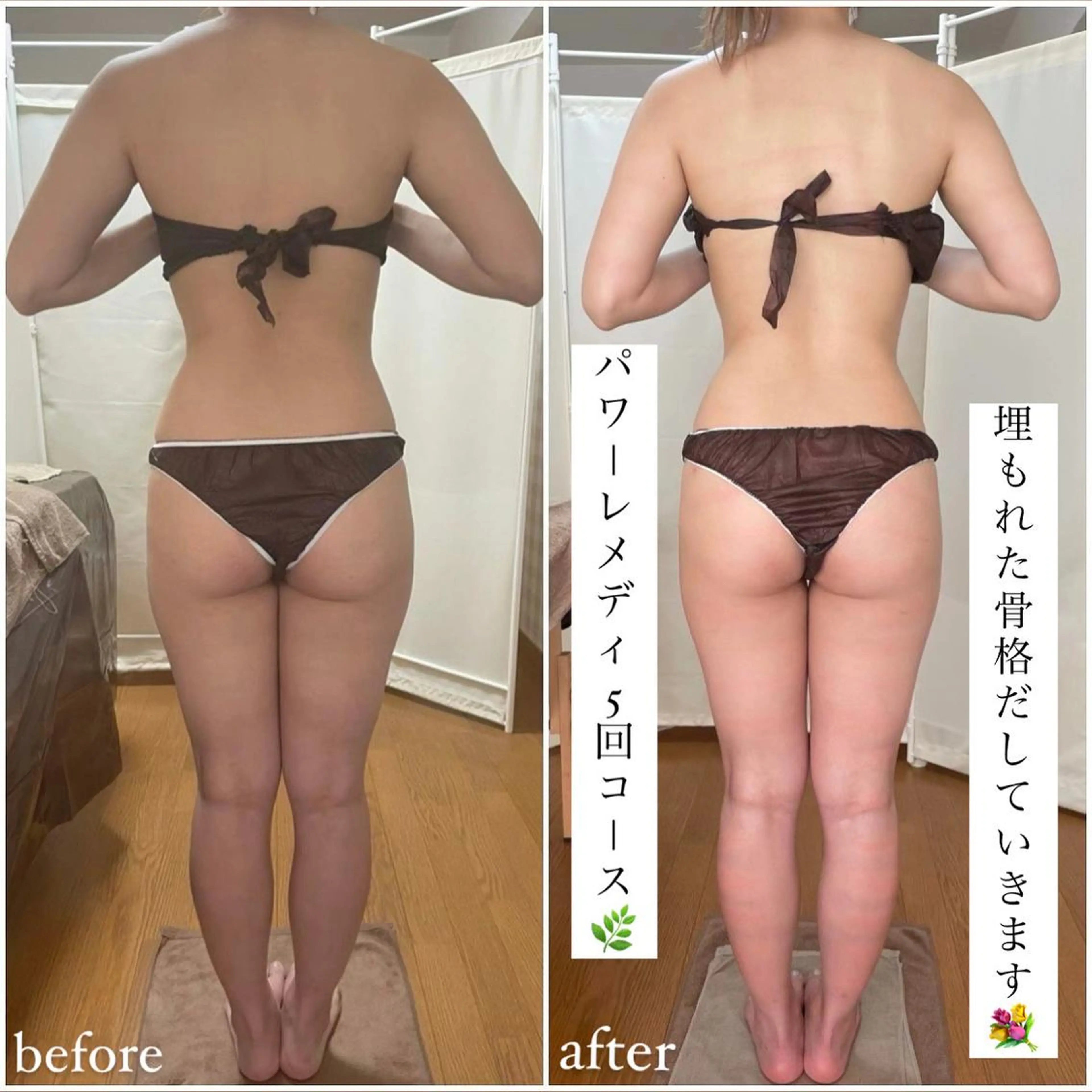 《本気痩せ×疲労改善 》  BILOOPのエステ・リラクイメージ