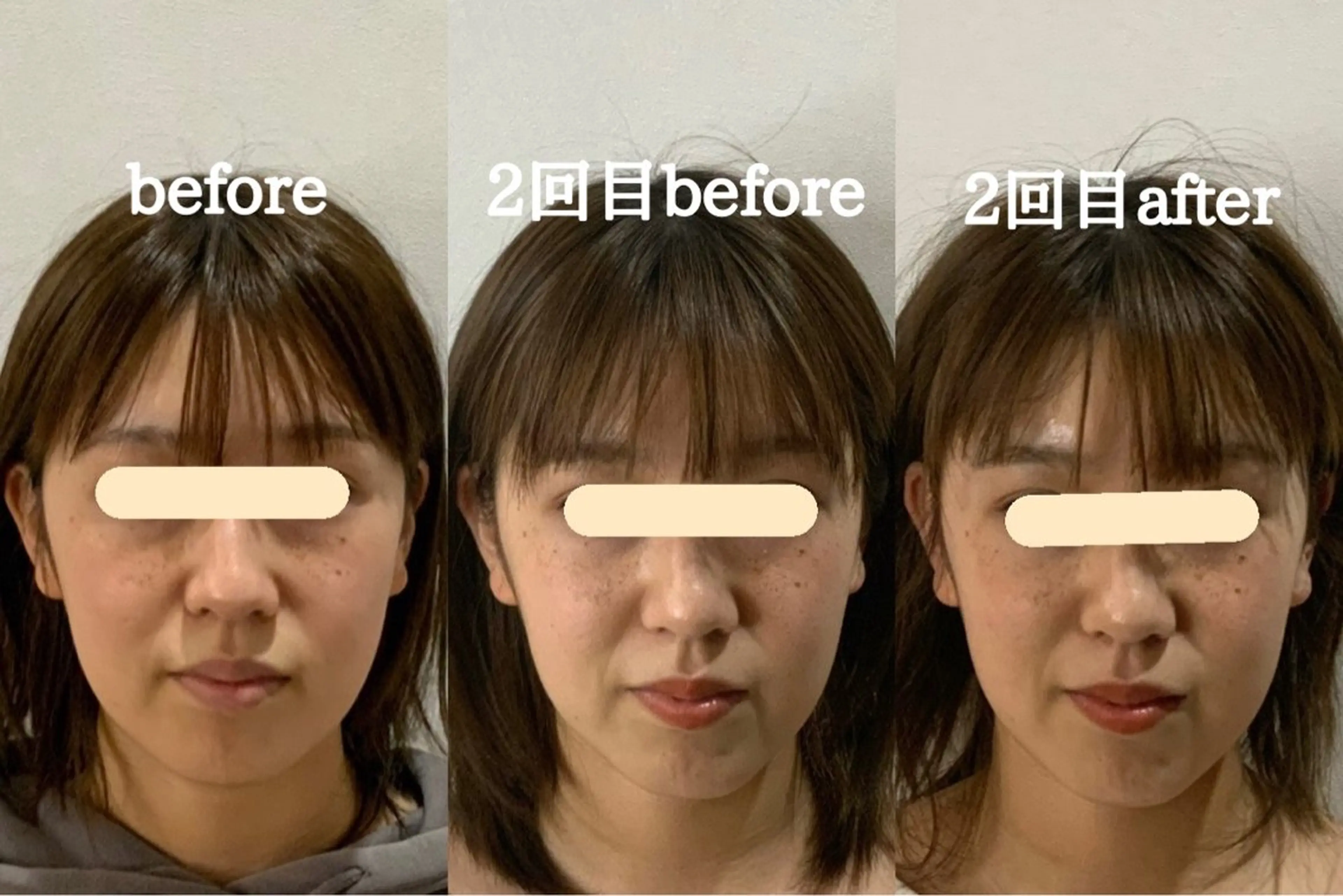 最速小顔・肌質管理 espoirマキのエステ・リラクイメージ