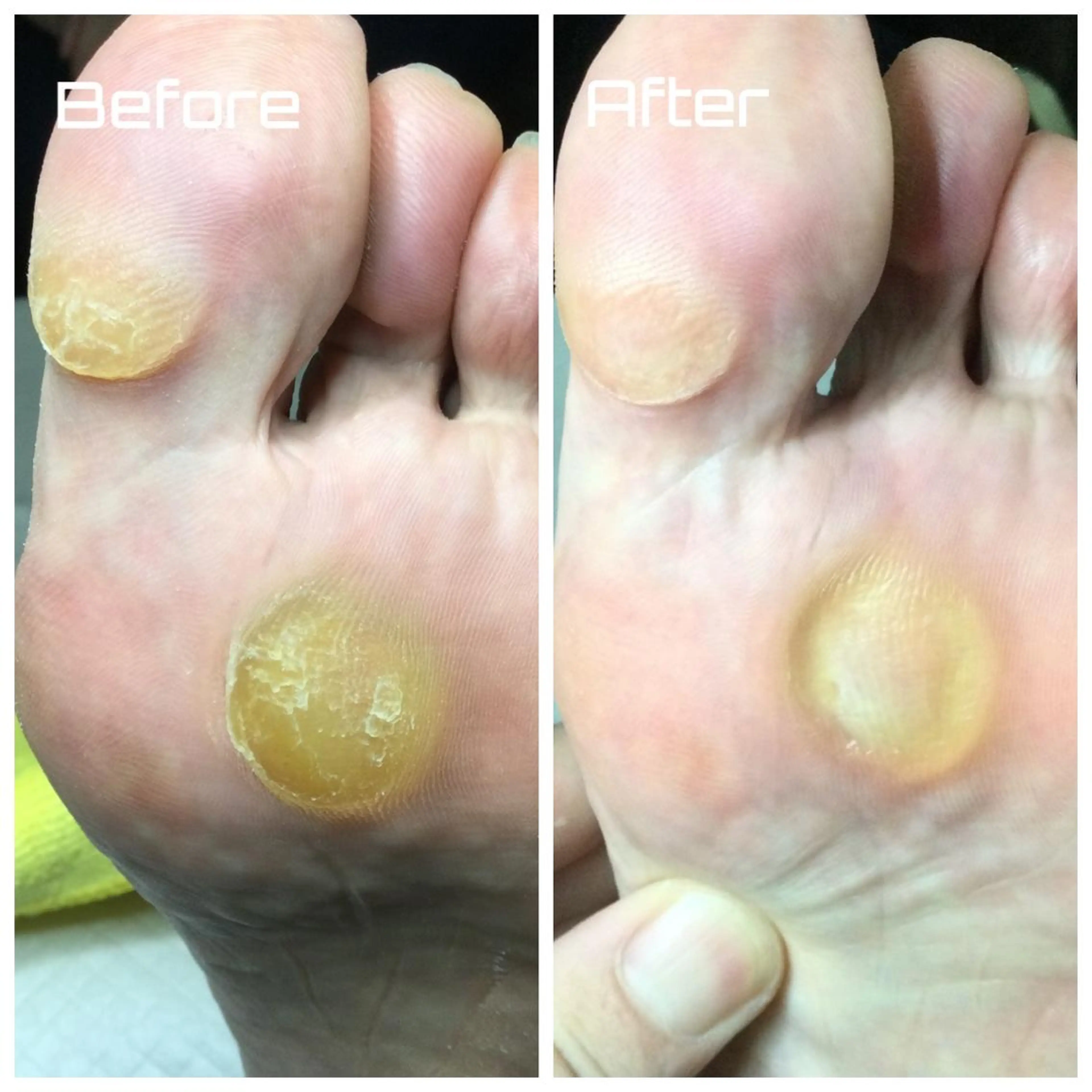 メンズ ネイル ドクターネイル爪革命 takahashiのその他イメージ