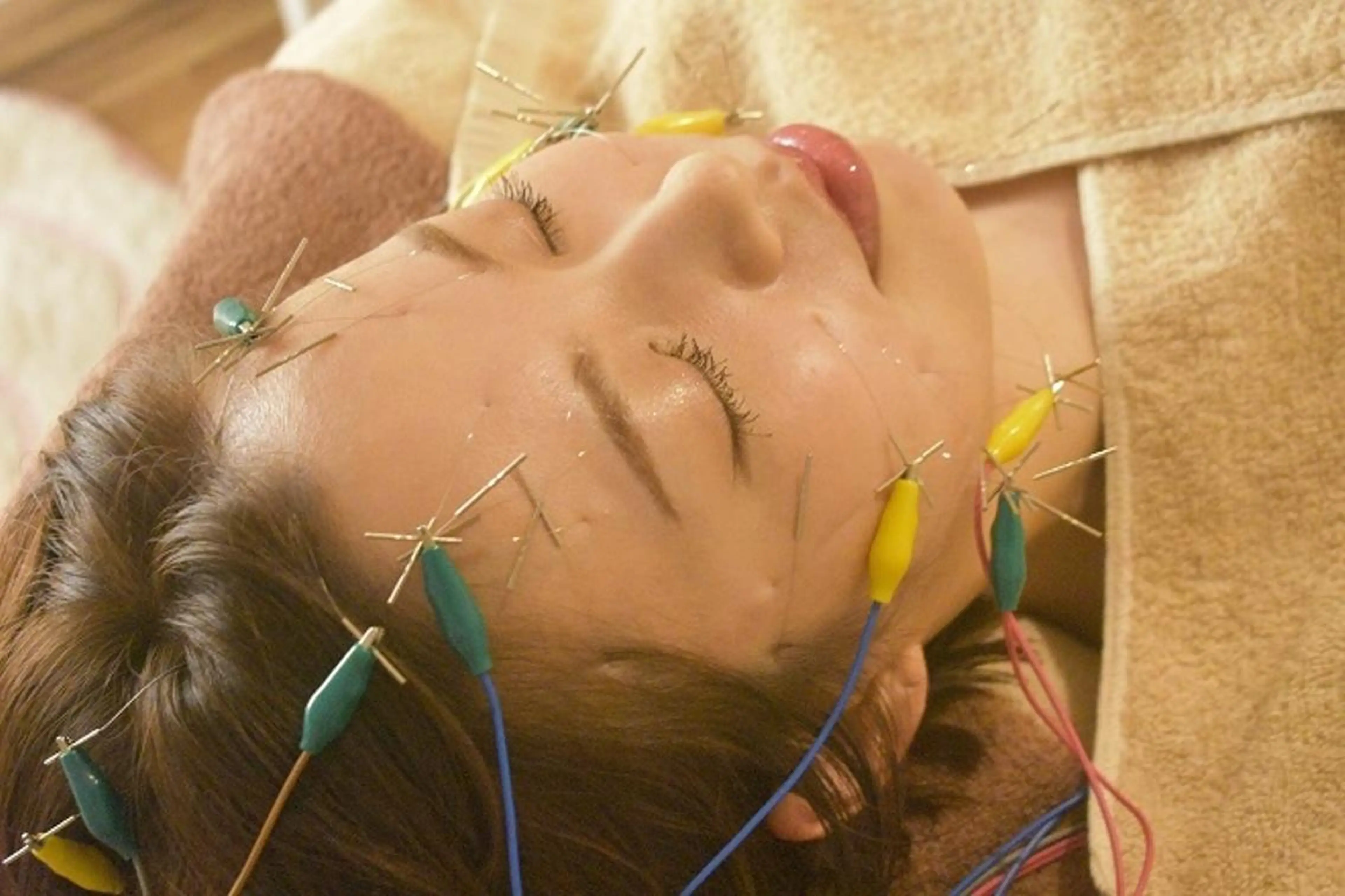 💙美容鍼💙美顔矯 正🧡Brilo🧡のエステ・リラクイメージ