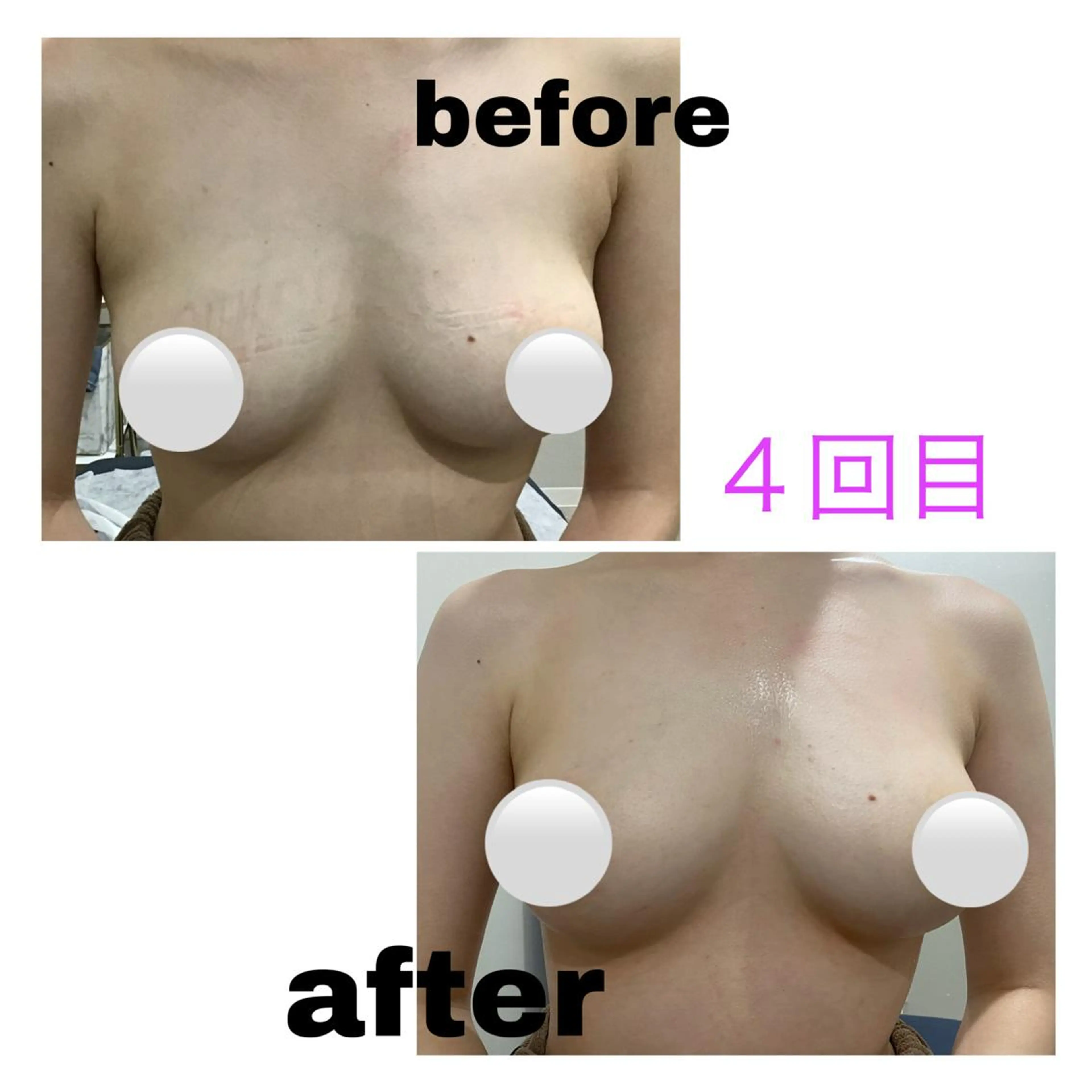 アルカンジュ~archange~所属・痩身/毛穴洗浄/脱毛 アルカンジュのエステ・リラクイメージ