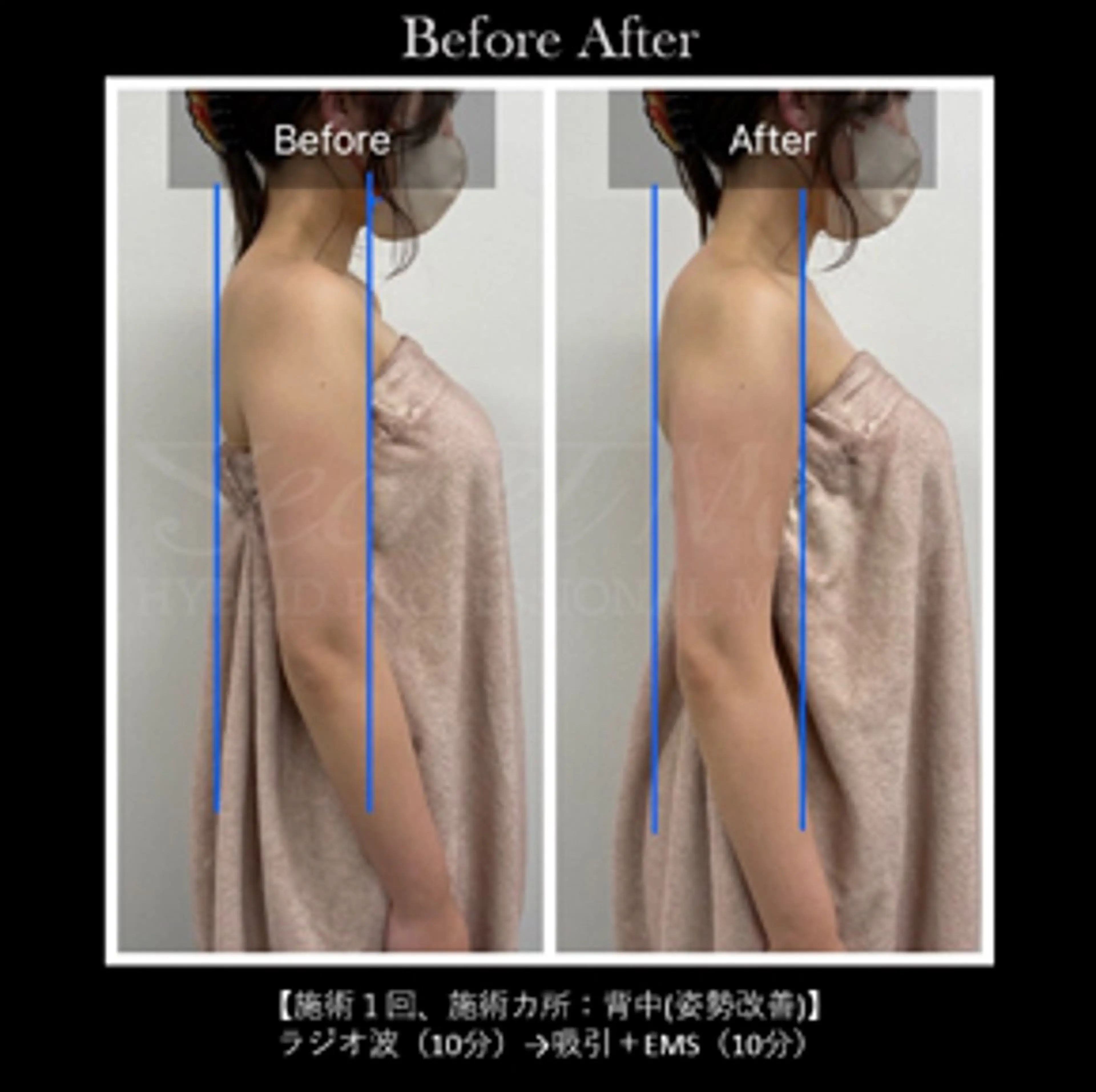 伊藤 正美のマツエク・マツパデザイン