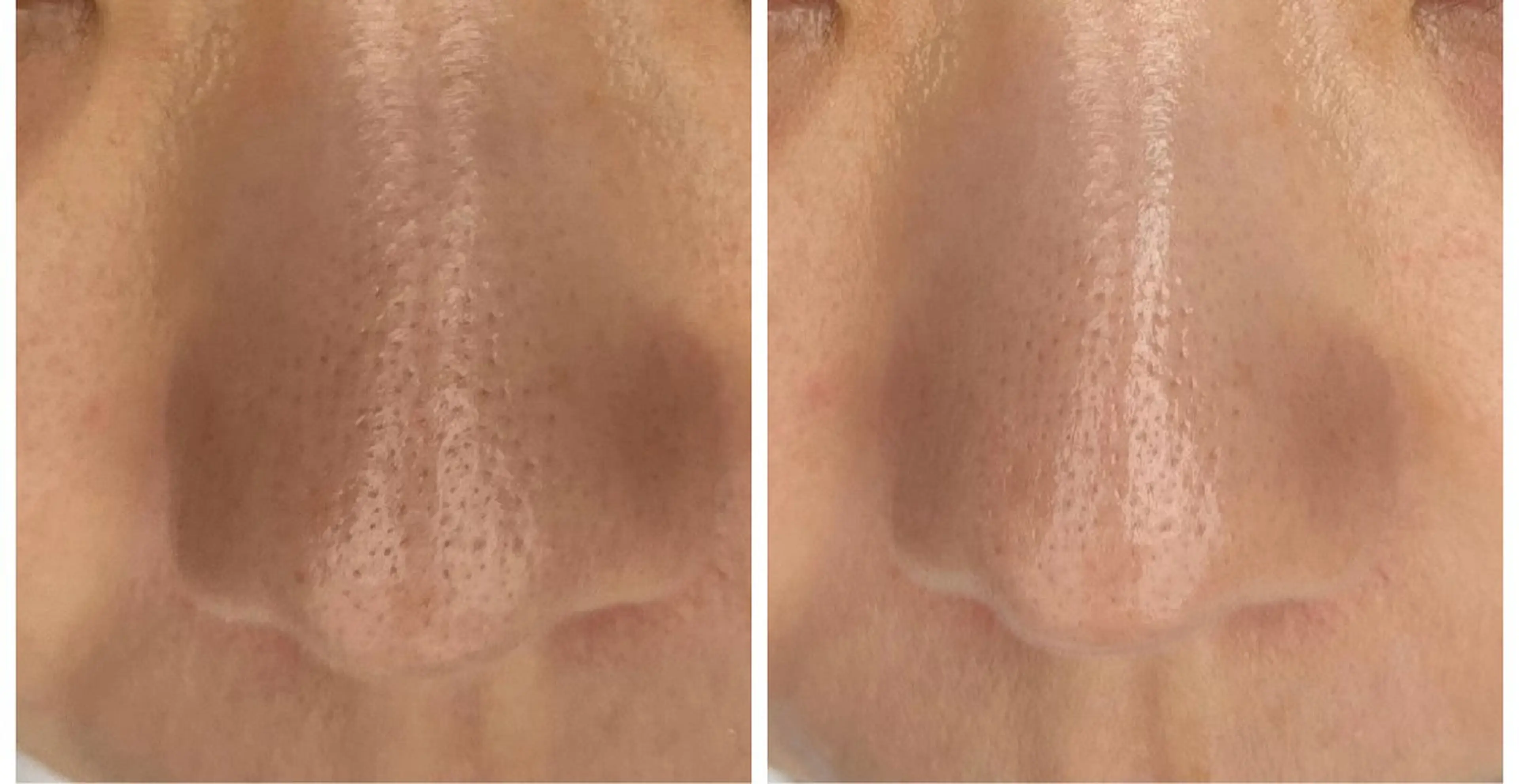 エステ エステサロン Libertaのその他イメージ