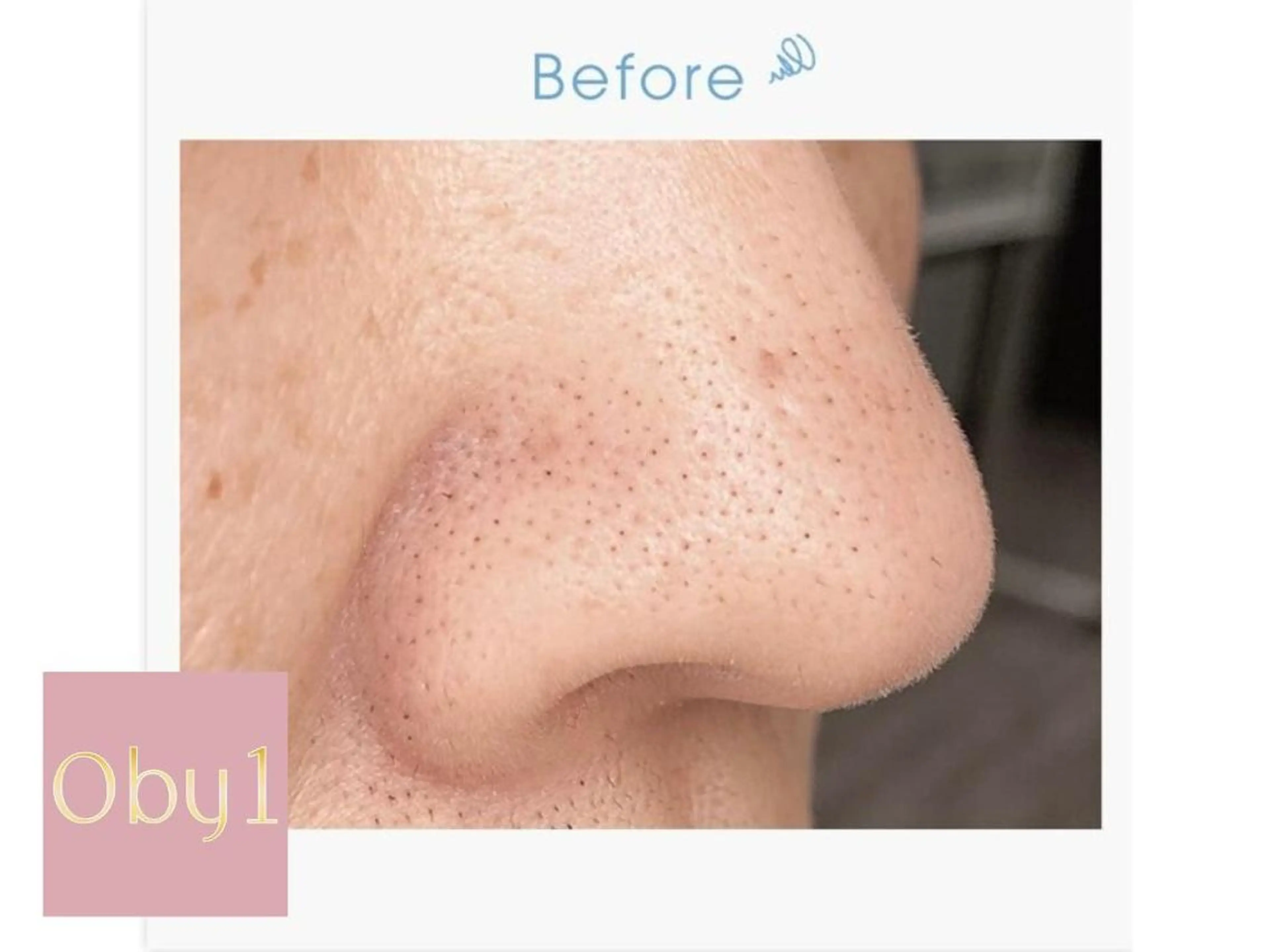 肌管理/ピーリング オーバイワン恵比寿のエステ・リラクイメージ