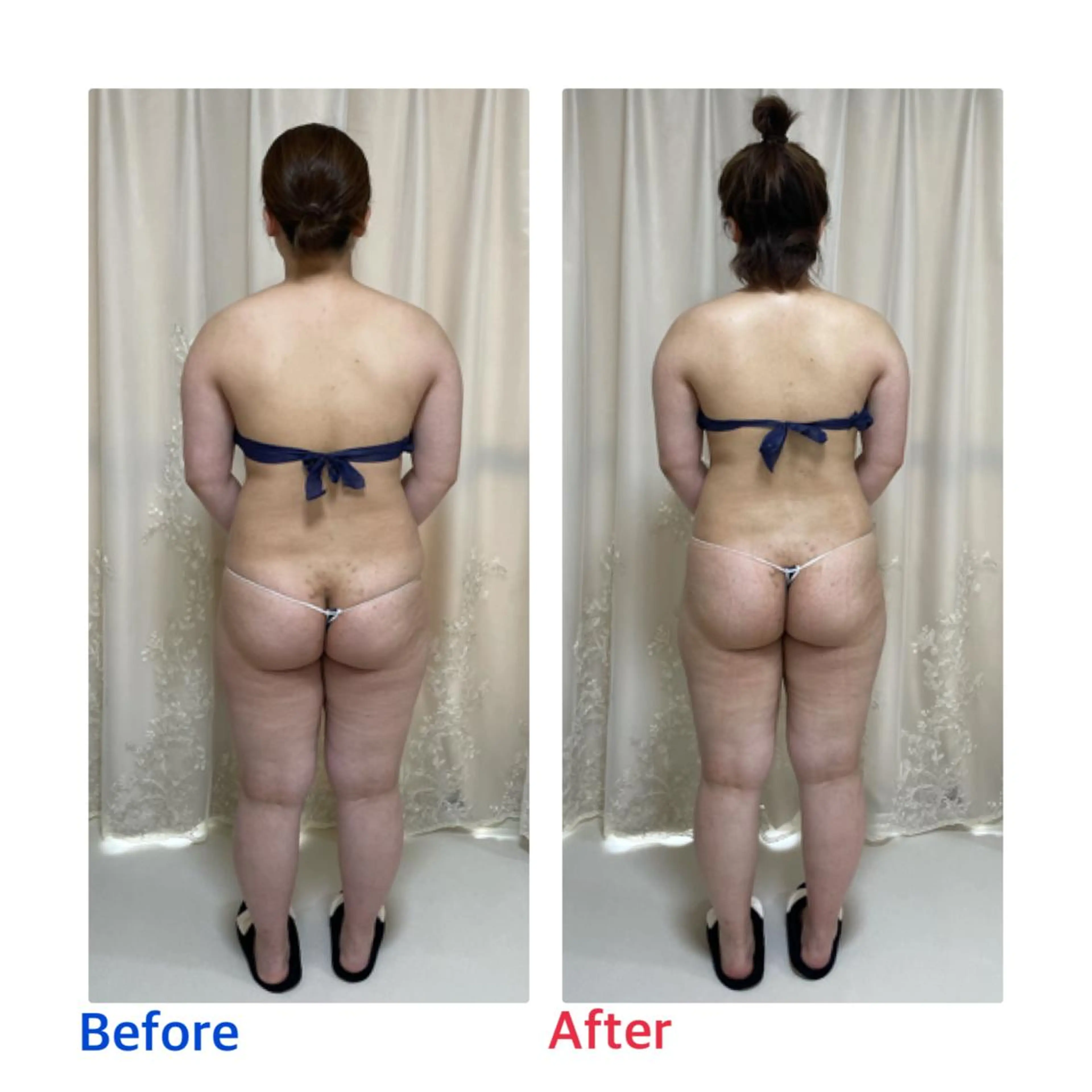 エステ リラク プライベートサロン moyoのエステ・リラクイメージ