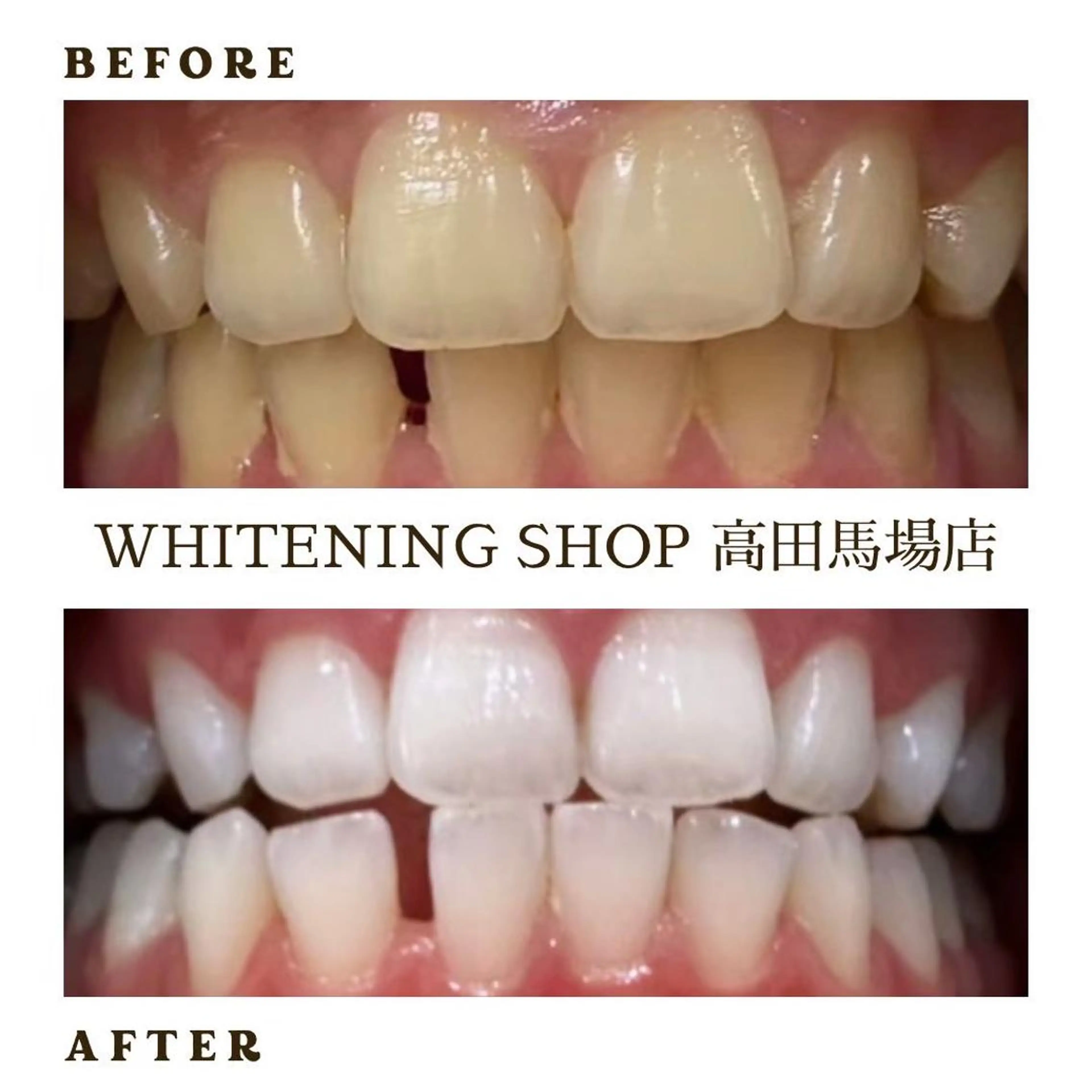 メンズ その他 ホワイトニング ショップ高田馬場店のその他イメージ
