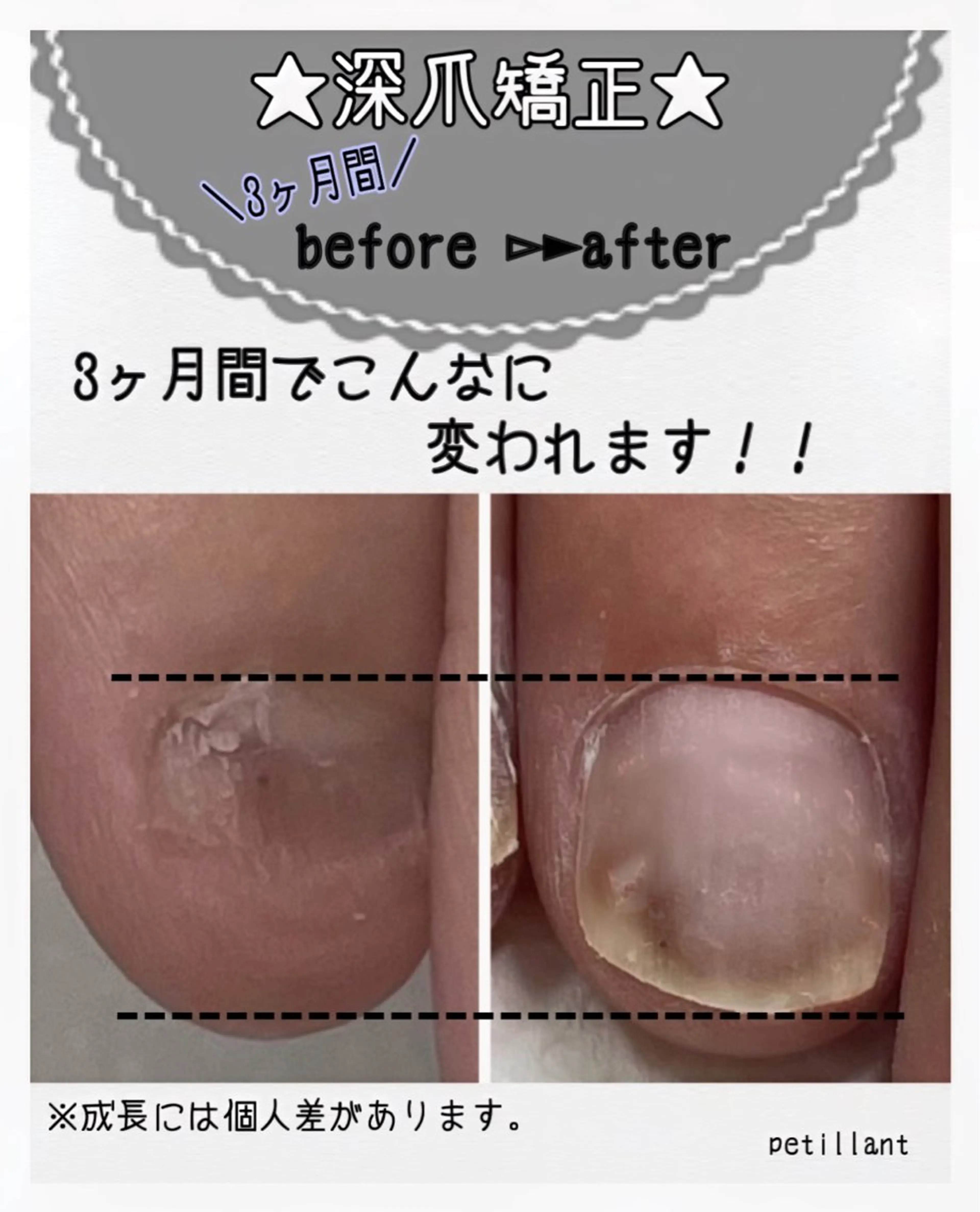 ネイル 長さ出し 卒業式 マットネイル nail salon petillantのネイルデザイン