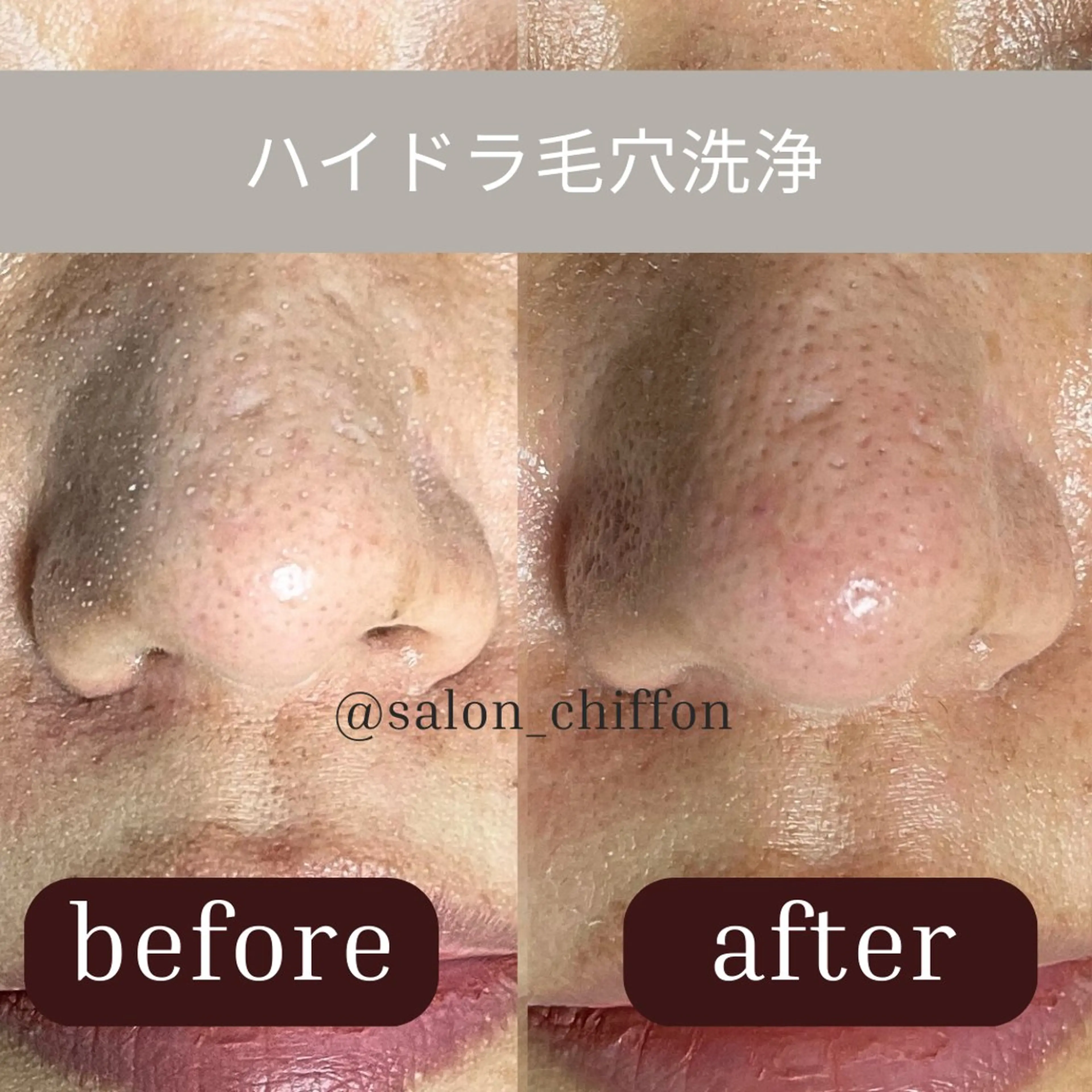 エステ リラク 肌質改善エステ chiffonのエステ・リラクイメージ