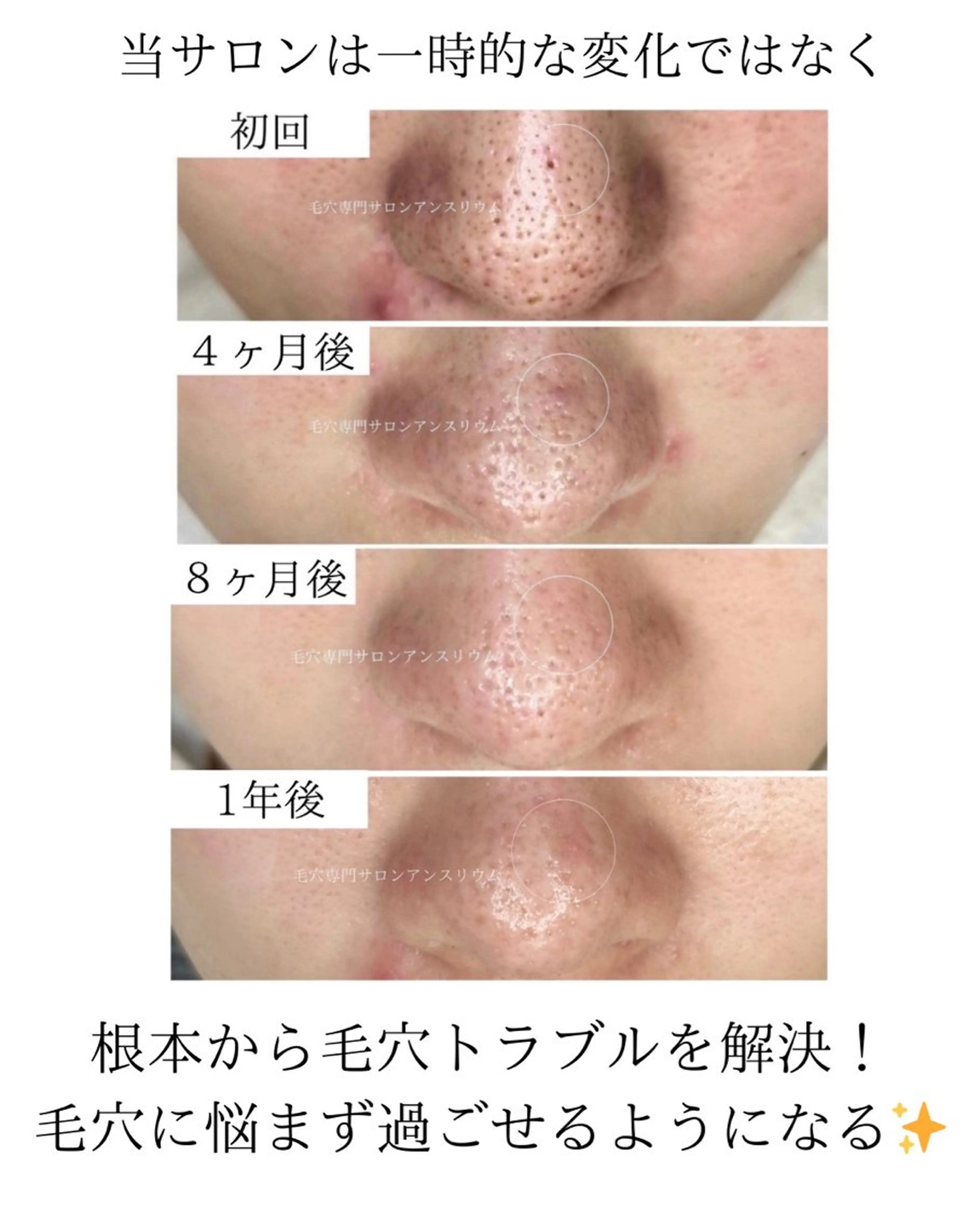 茨城土浦 つくば毛穴 ケア専門サロンのエステ・リラクイメージ