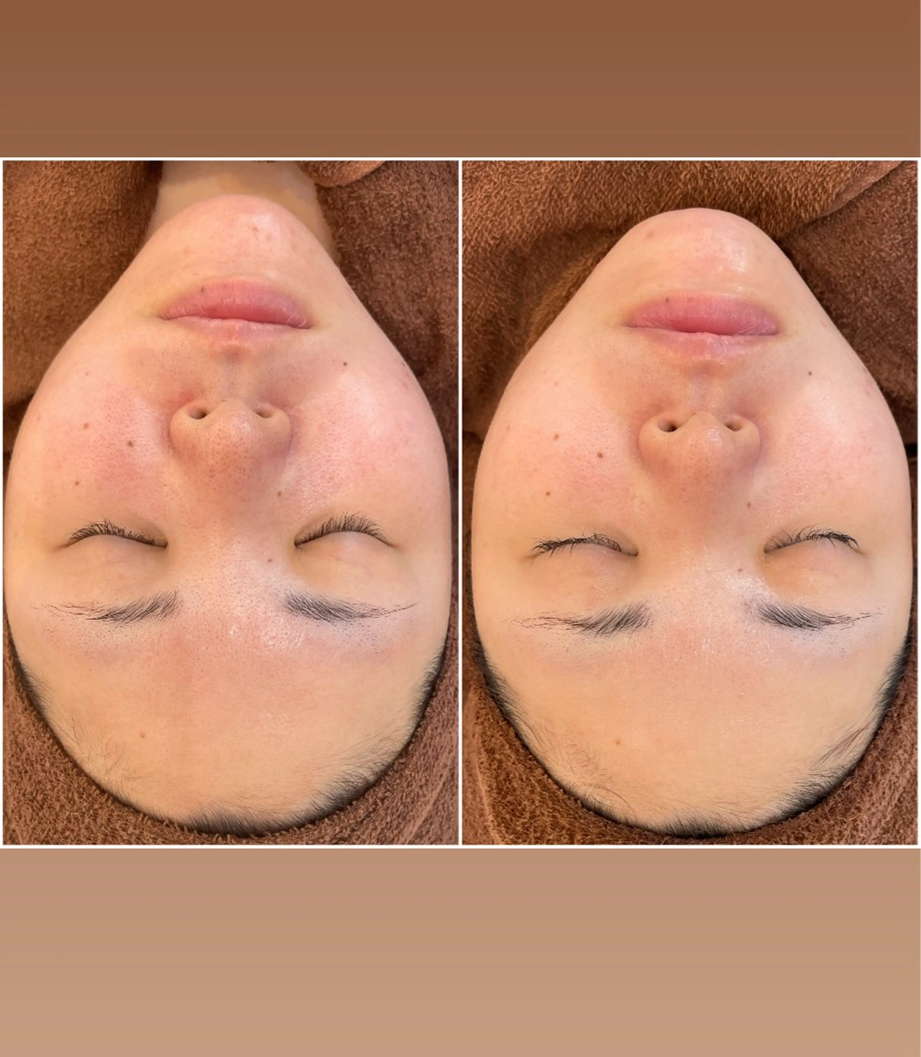 エステ リラク パーソナルスキンケア 🦋APRI🅿️有のエステ・リラクイメージ