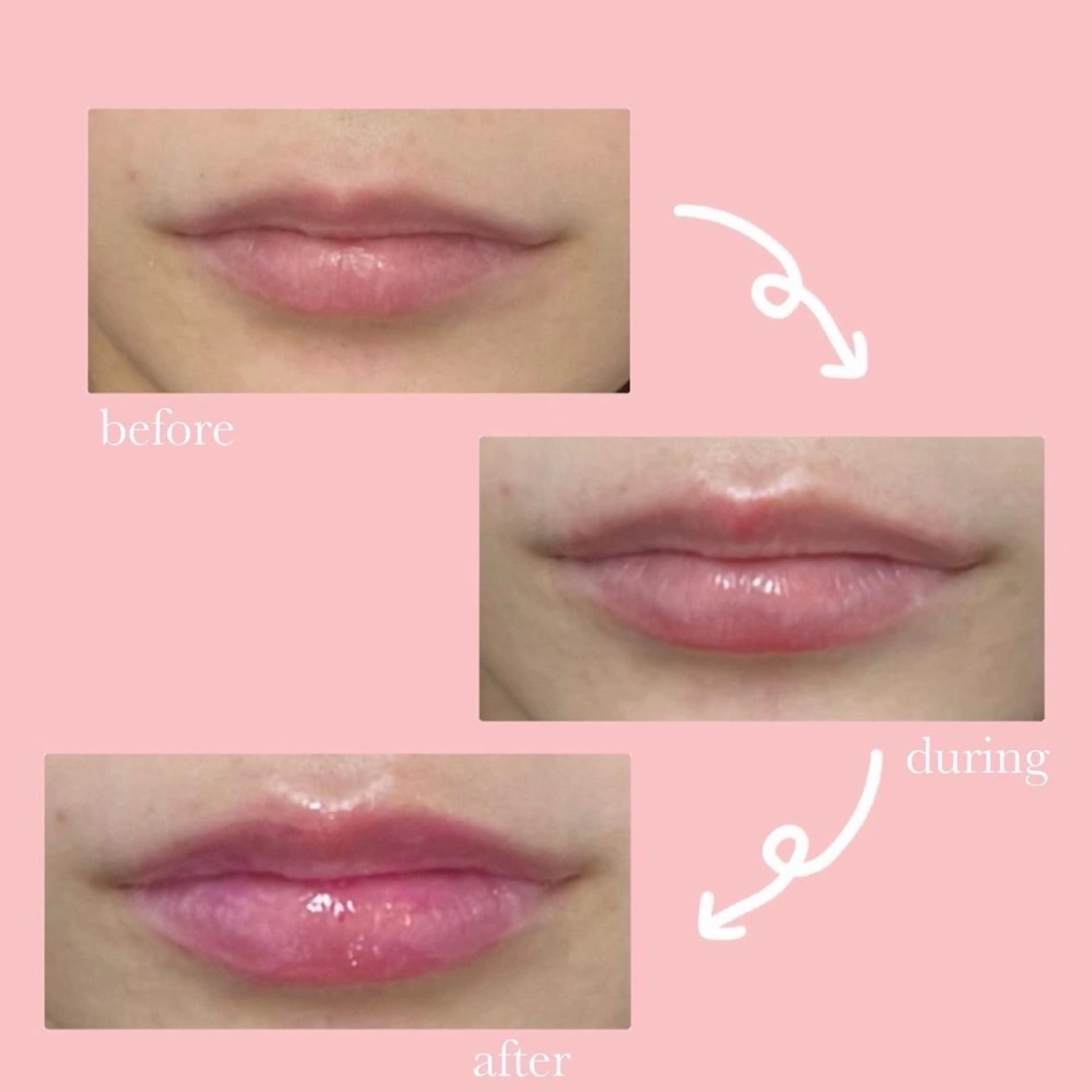 RinRin  福山店のエステ・リラクイメージ