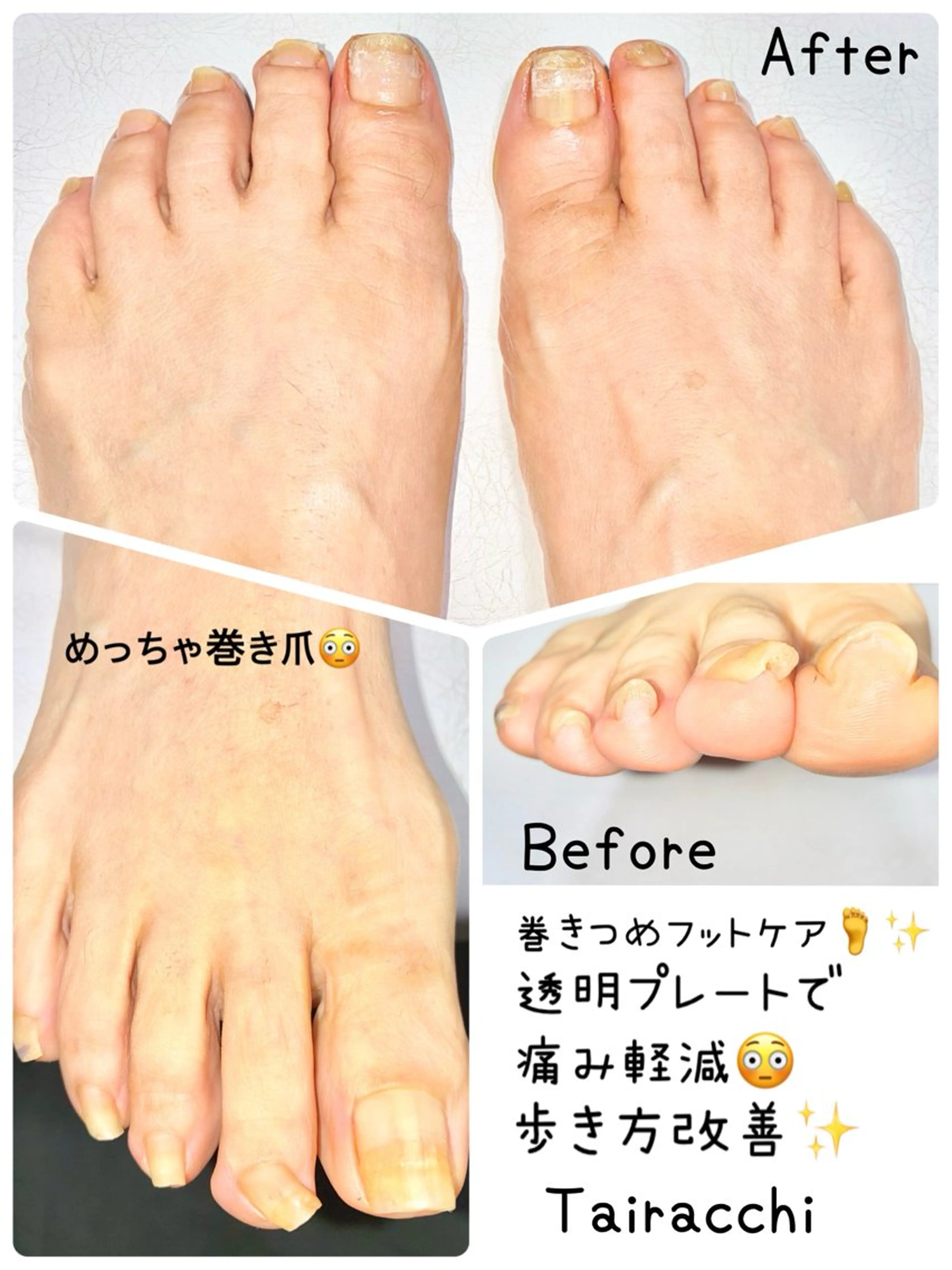 ネイル フットネイル Tairacchi ﾀｲﾗｯﾁのエステ・リラクイメージ