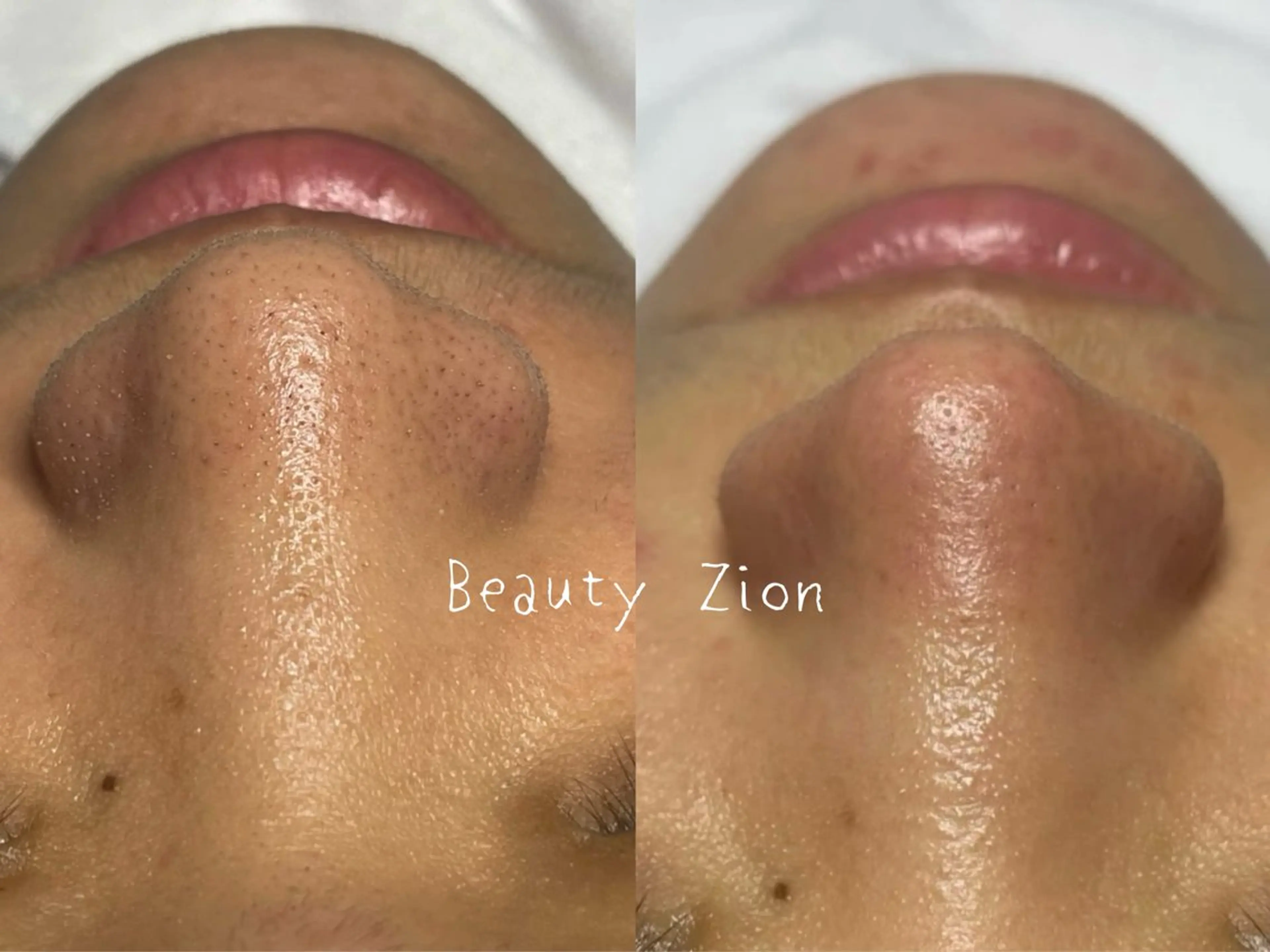 Beauty Zionのエステ・リラクイメージ