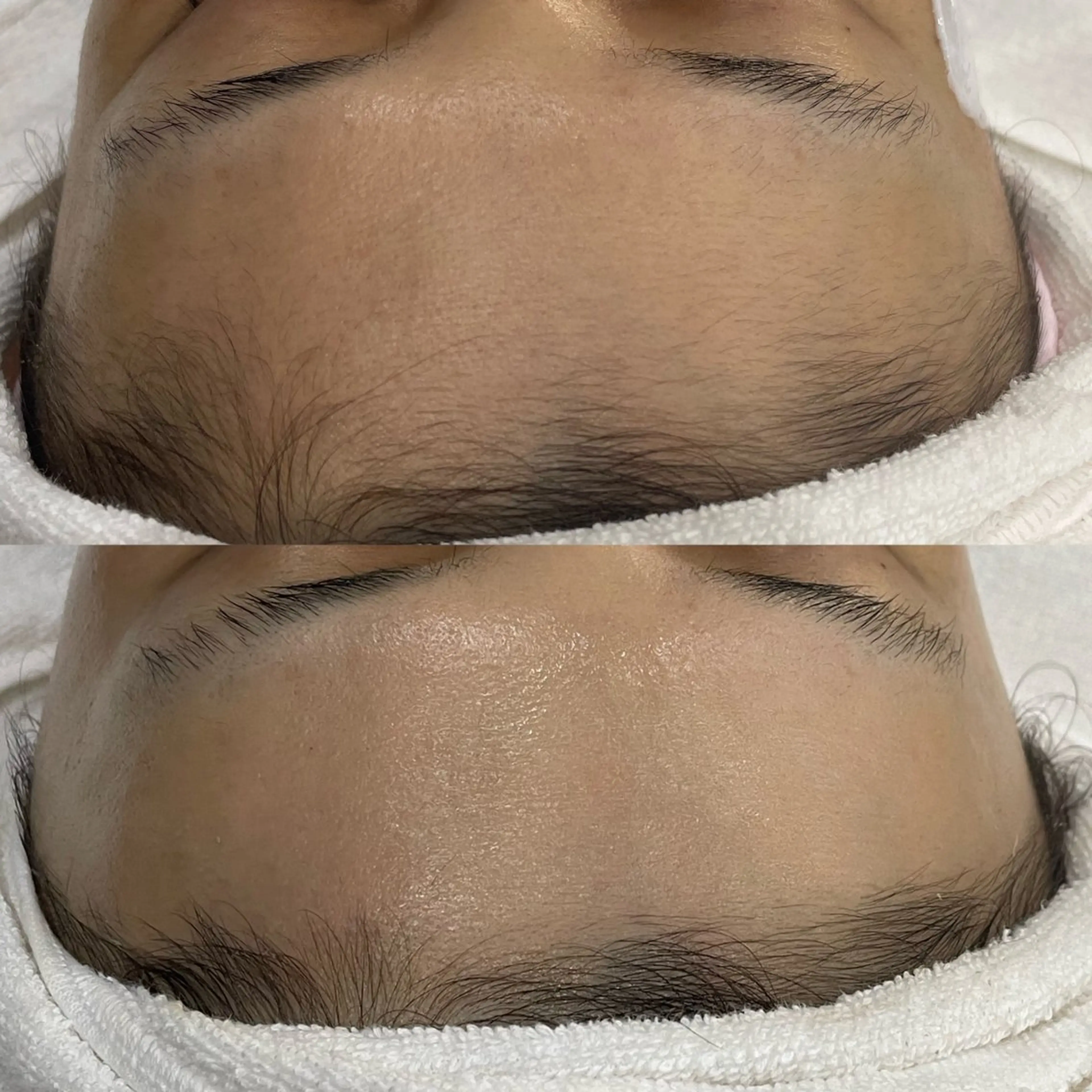 エステ lazo MIYOのマツエク・マツパデザイン