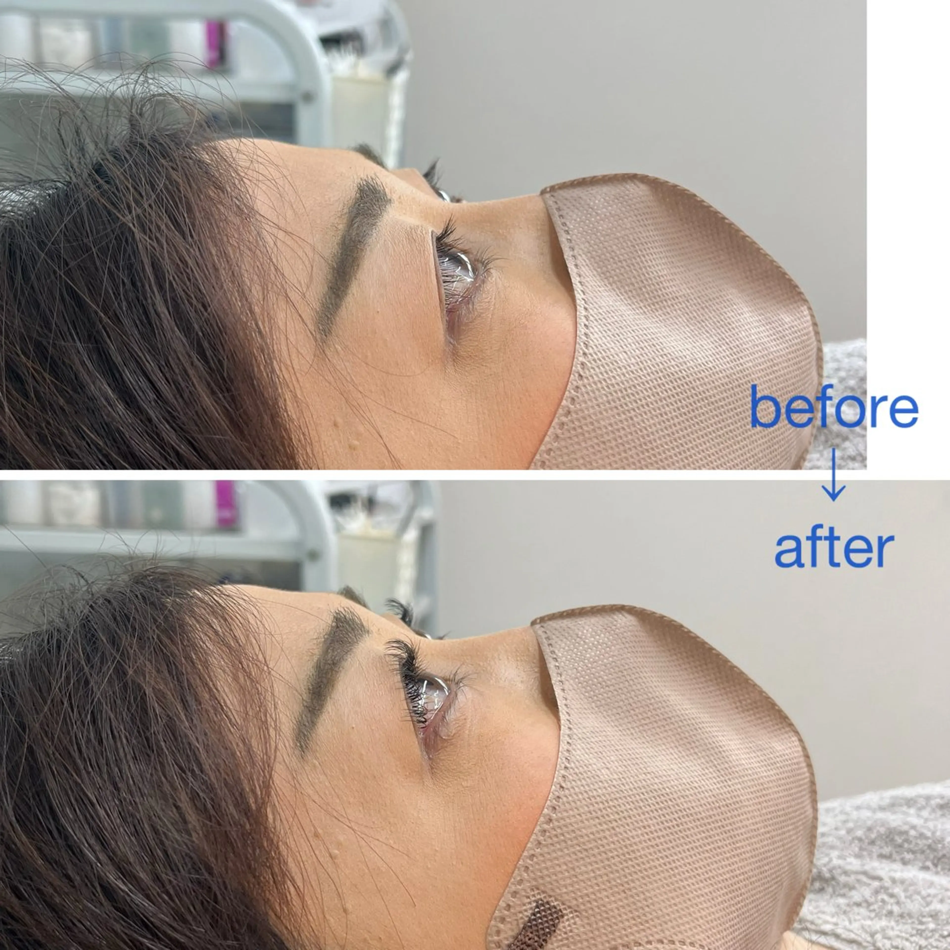 マツエク・マツパ フラットラッシュ Lカール 一重×まつ毛パーマ マツエク Enn. Risaのマツエク・マツパデザイン