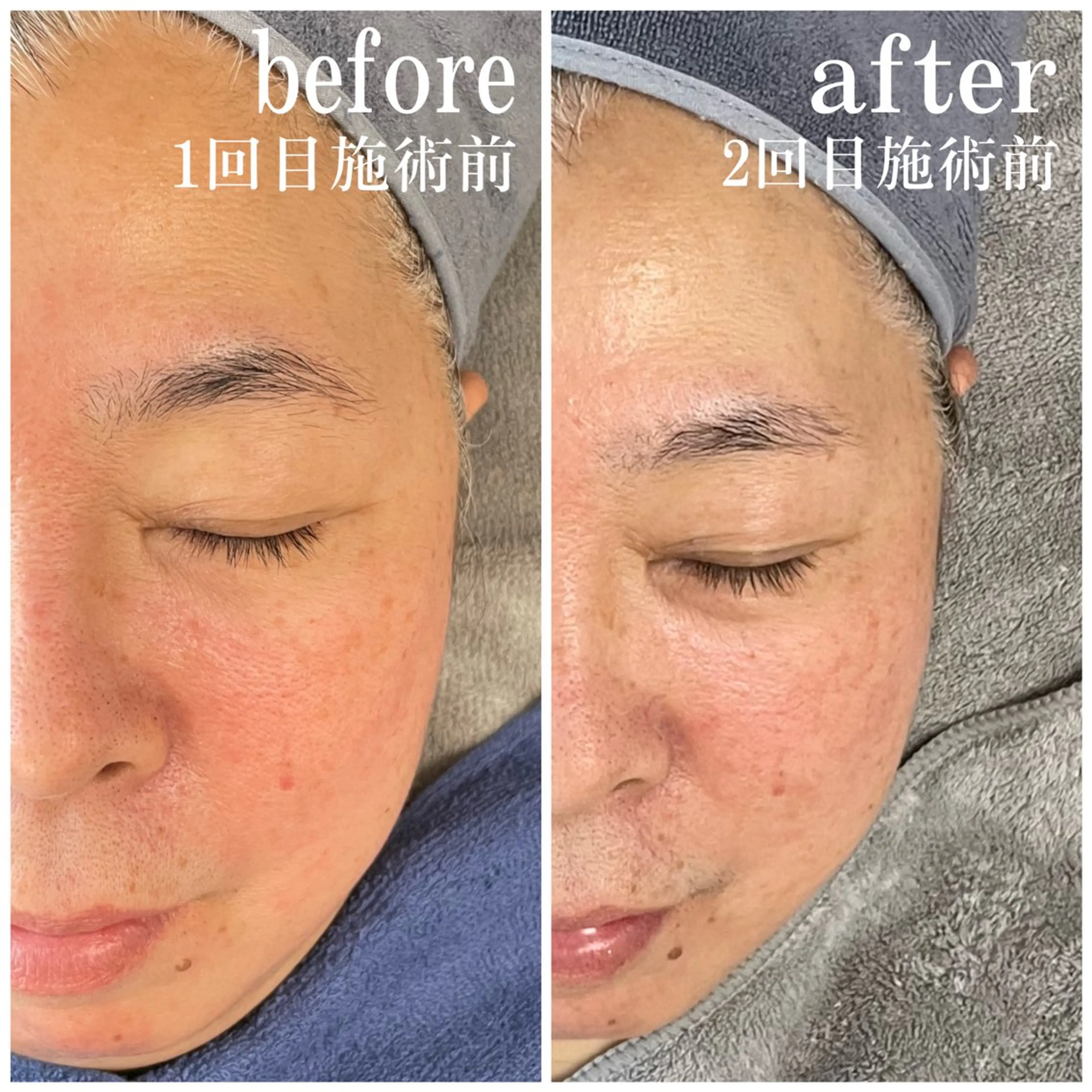 サロンピュア 所沢店のエステ・リラクイメージ