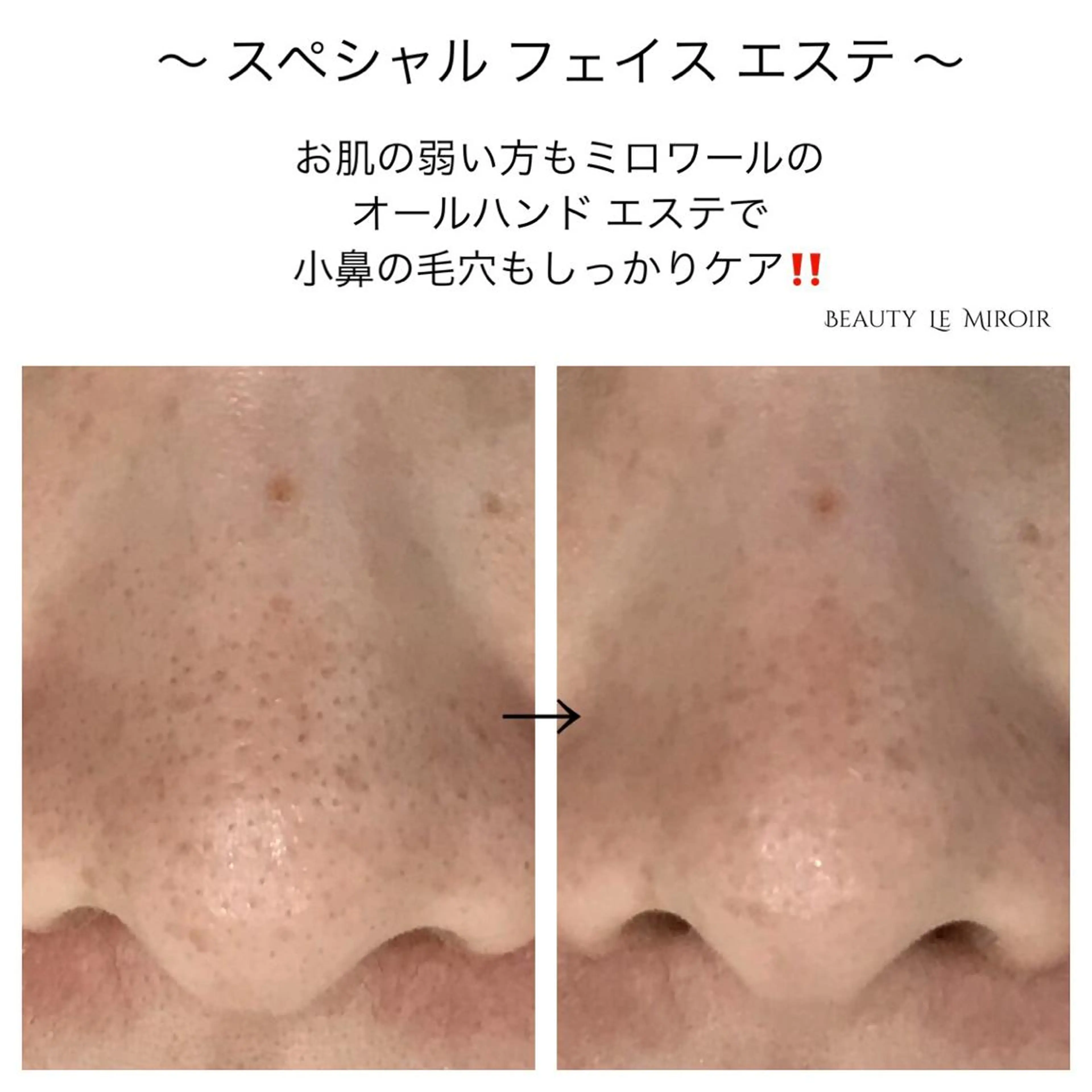 ビューティー ミロワールのエステ・リラクイメージ