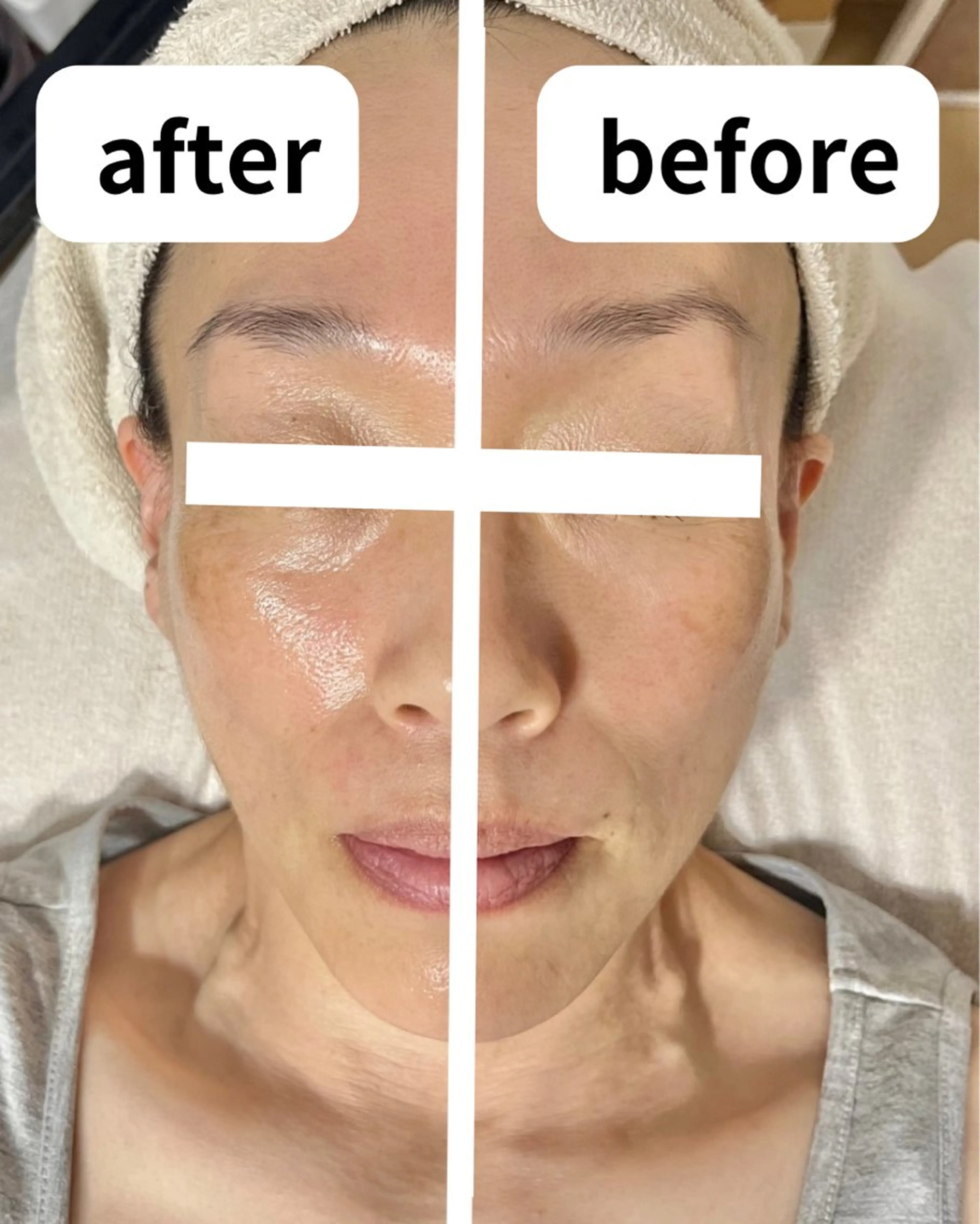 都度払い脱毛サロン Haleのエステ・リラクイメージ