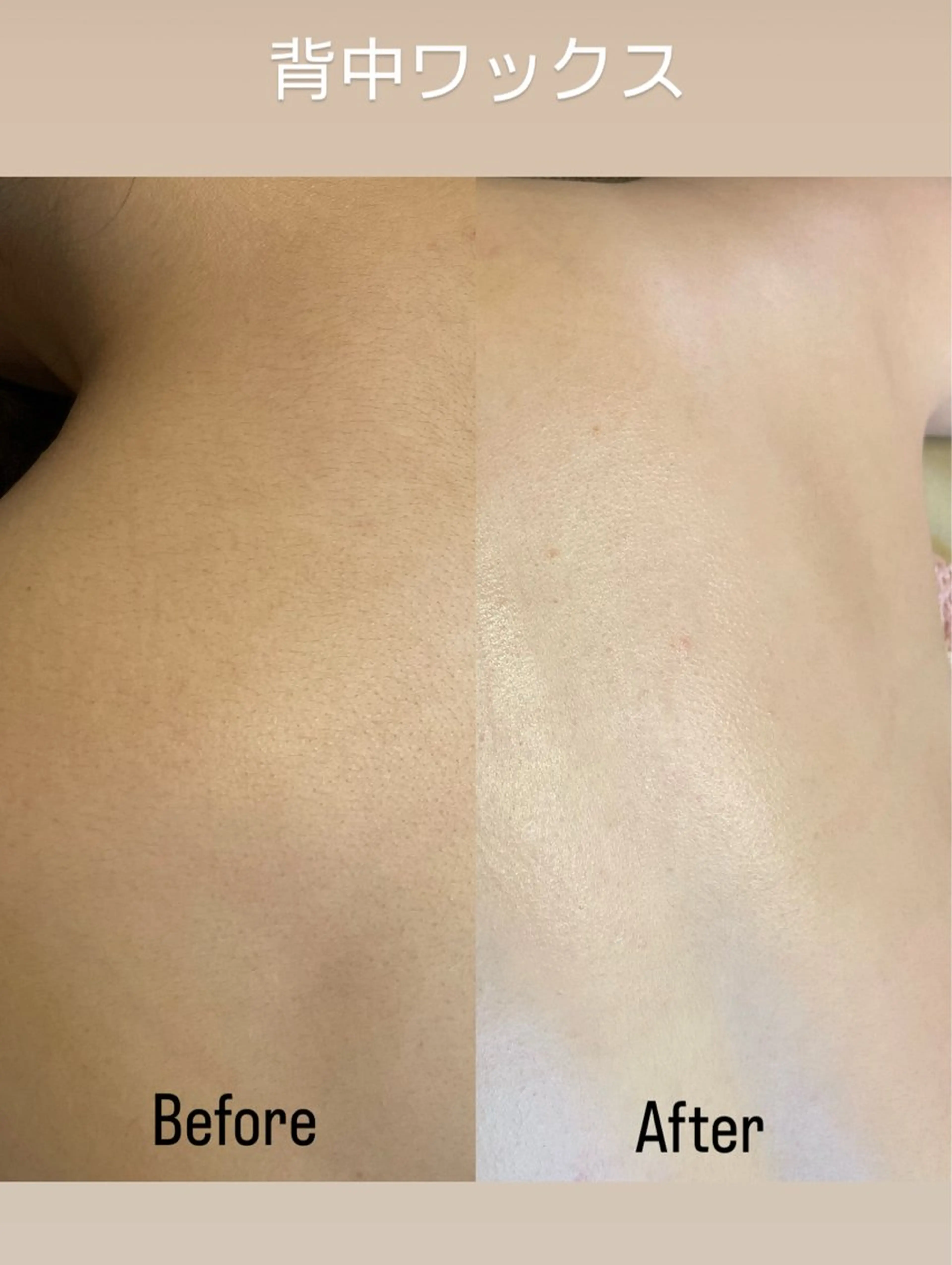 代表 MOMOのエステ・リラクイメージ