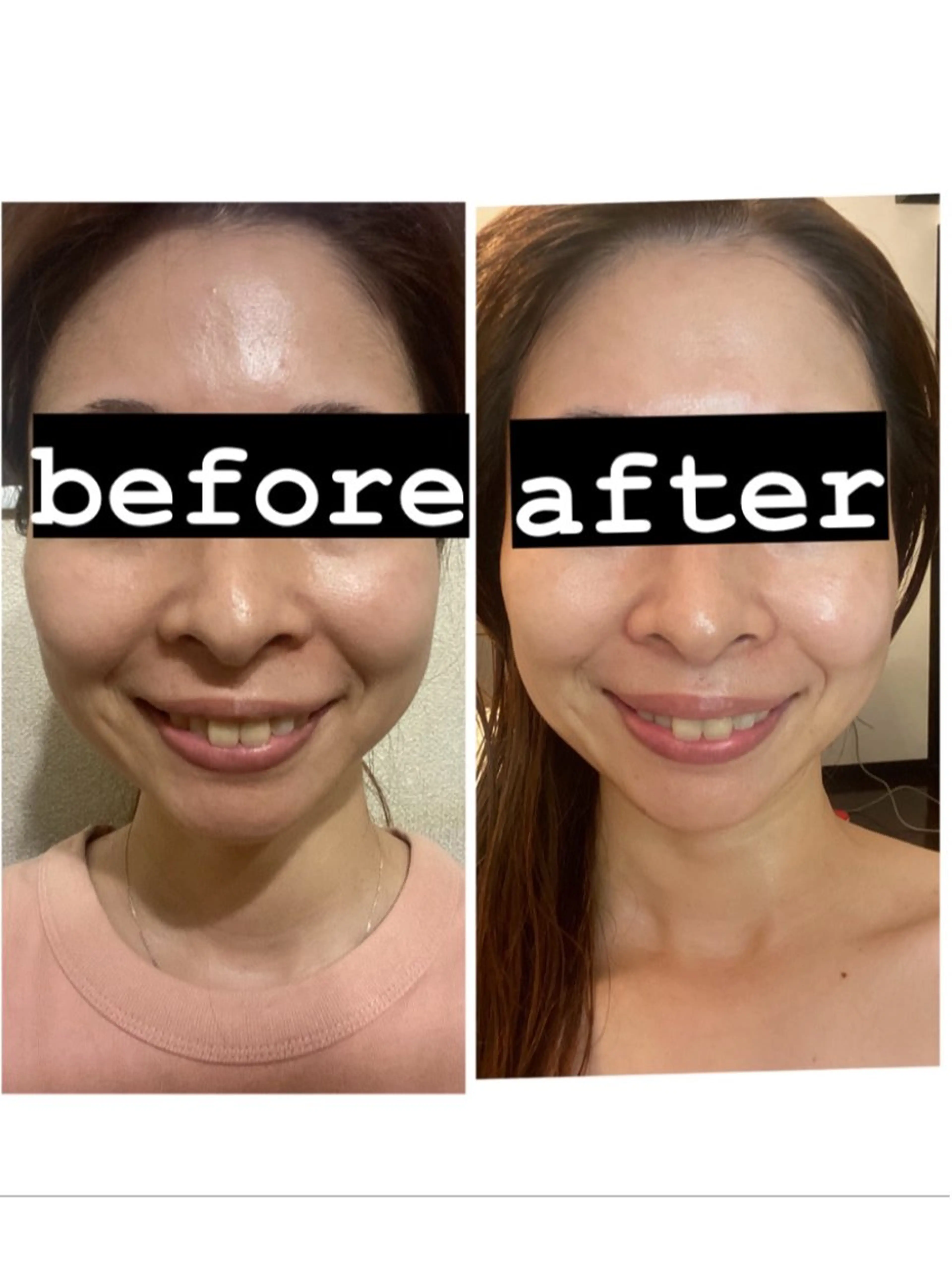 脱毛・エステサロン LuLuNのエステ・リラクイメージ