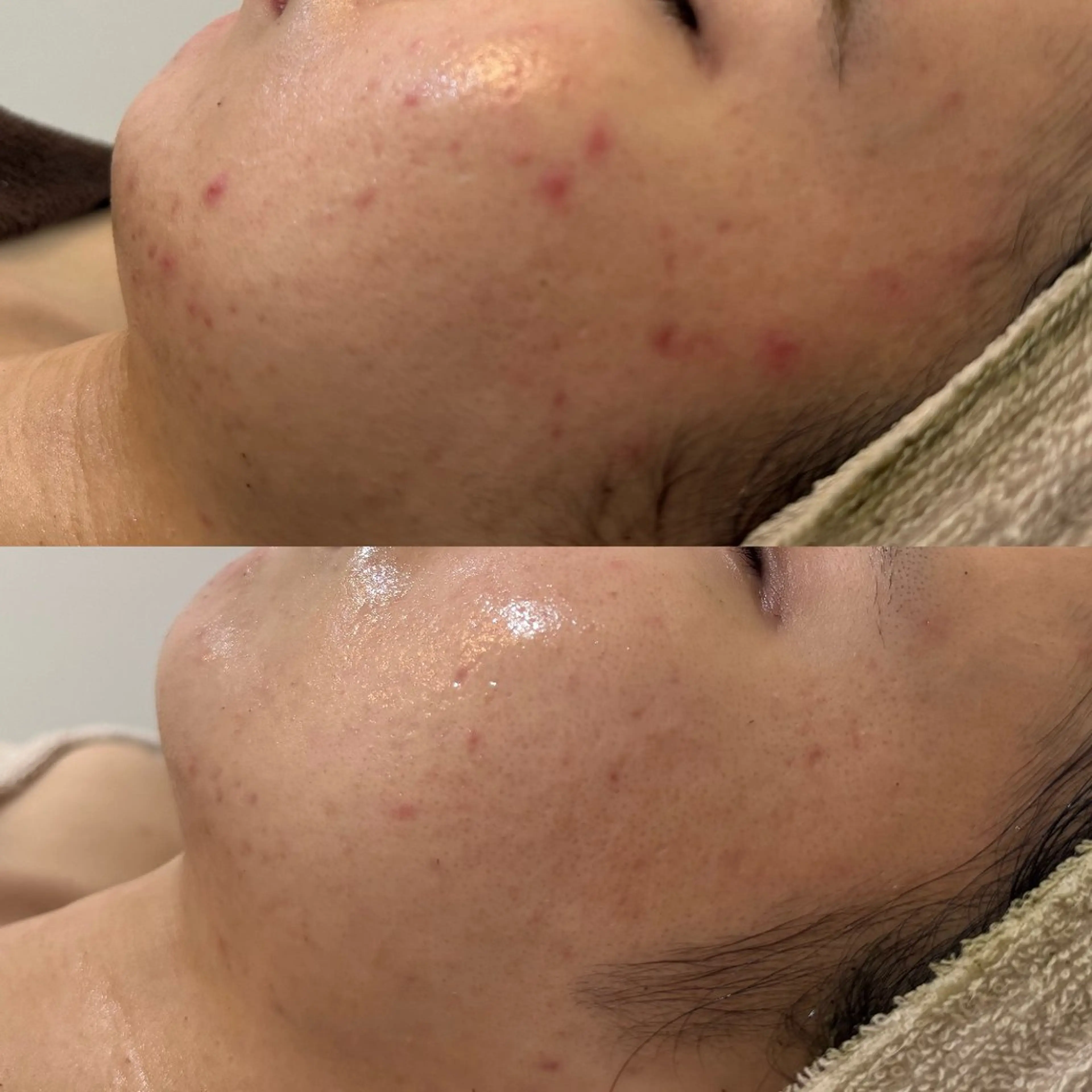 Nicore所属・肌質改善🌿まつ毛 chapiのその他イメージ