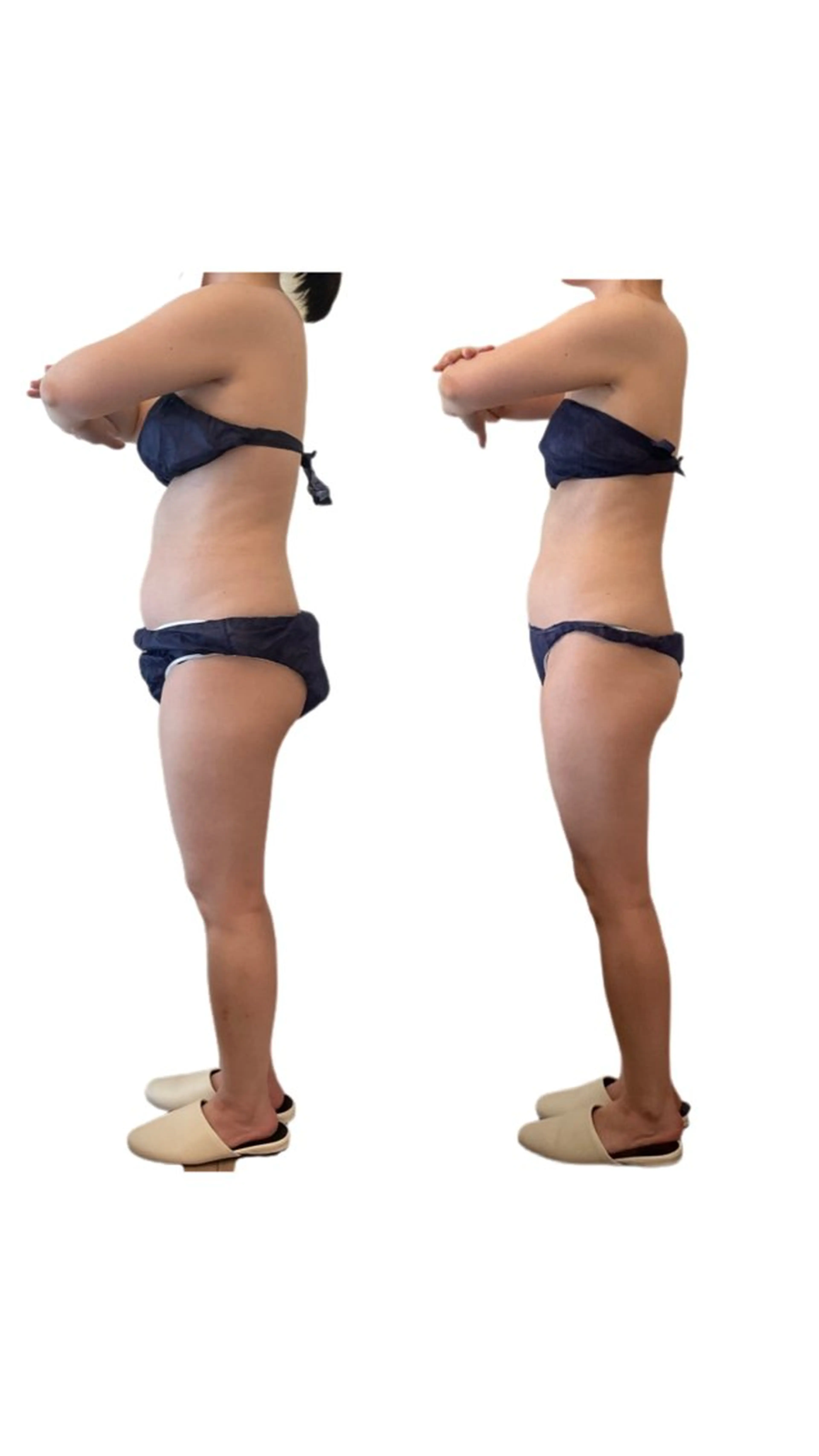 人気NO.2✨【気になる部位徹底燃焼◎】滝汗デトックス痩身🔥100分の写真