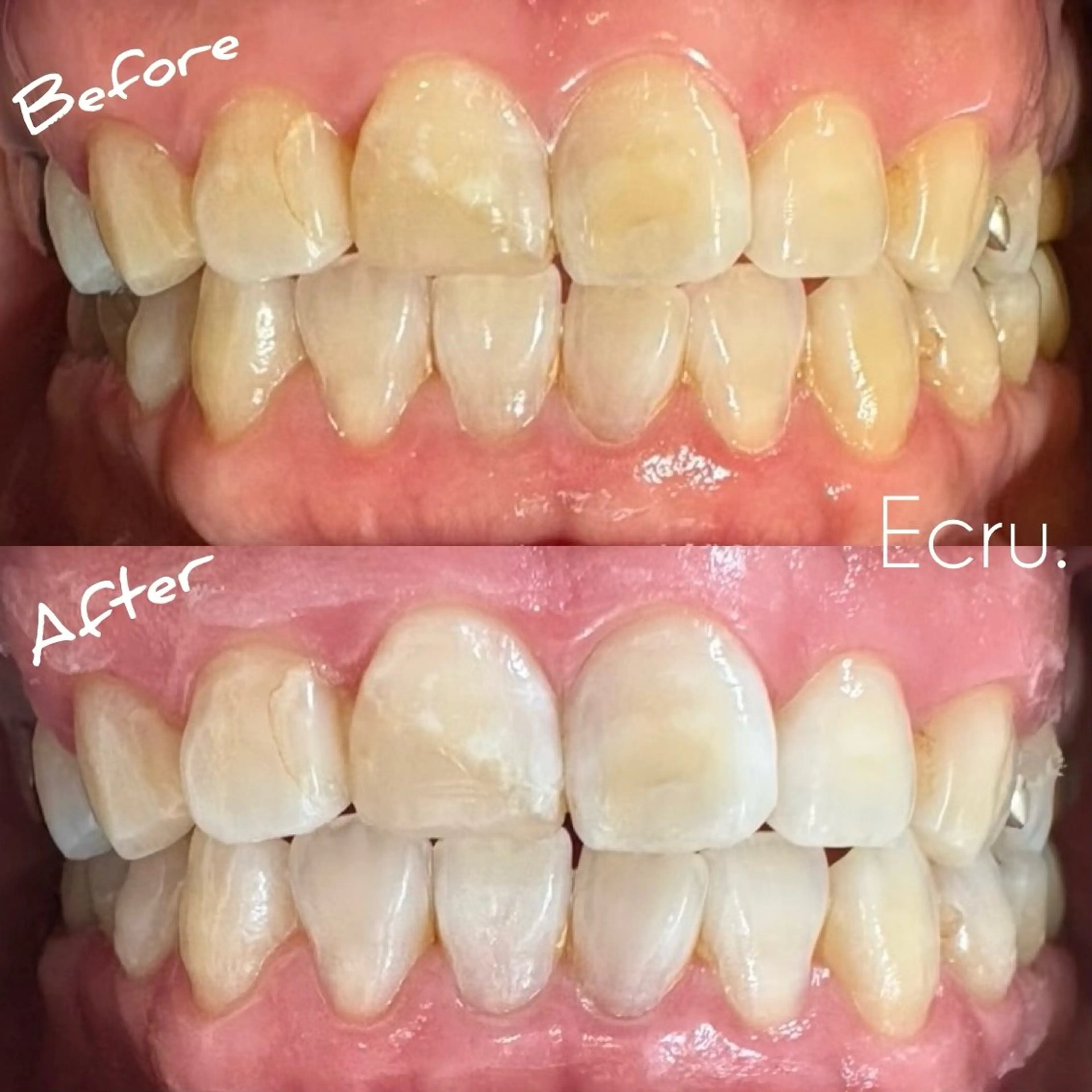 メンズ キッズ エステ ホワイトニングサロン Ecru所属・ホワイトニングサロン Ecru エクリュのその他イメージ