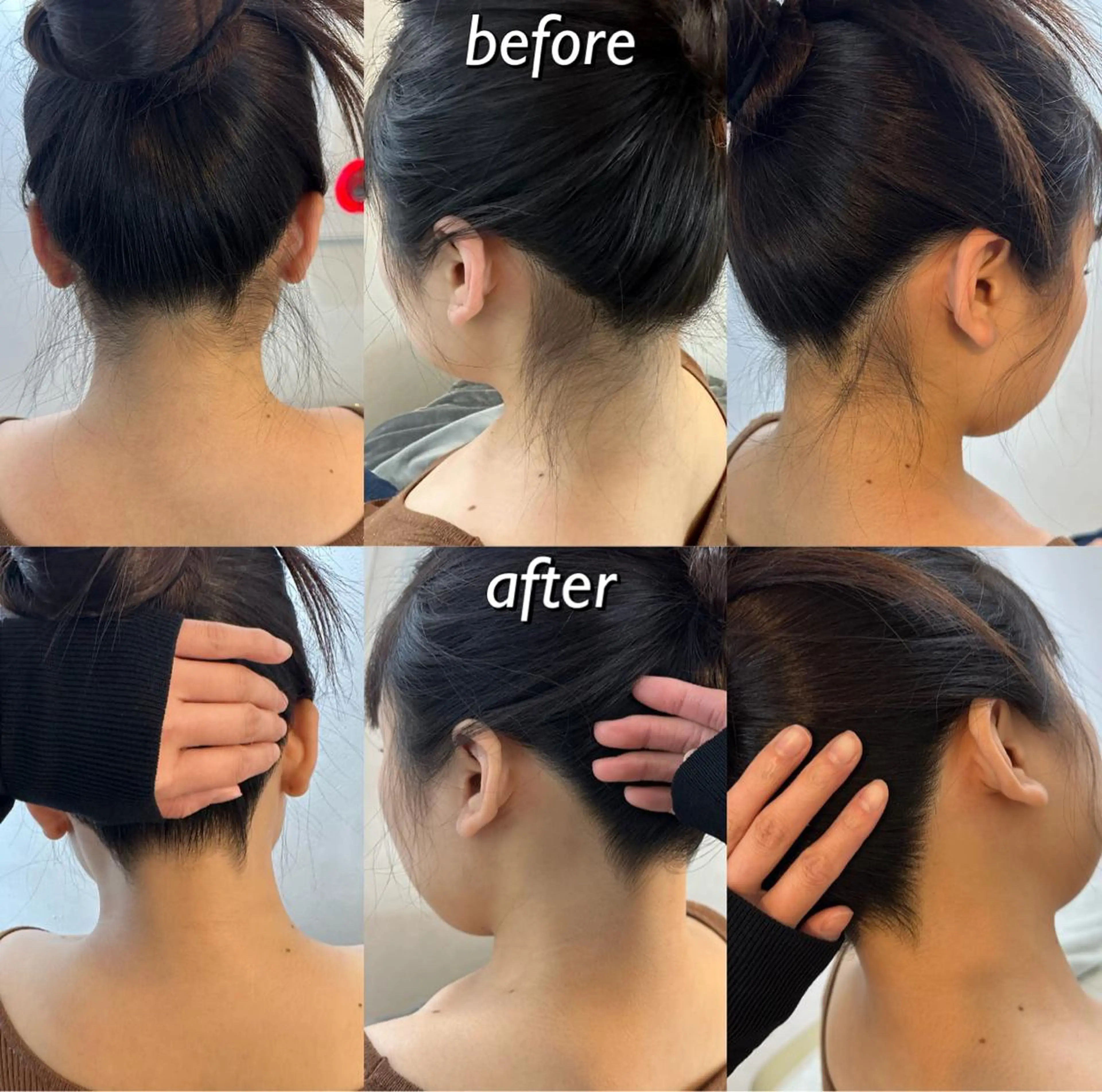 うなじ脱毛/美肌脱毛 LABELのエステ・リラクイメージ