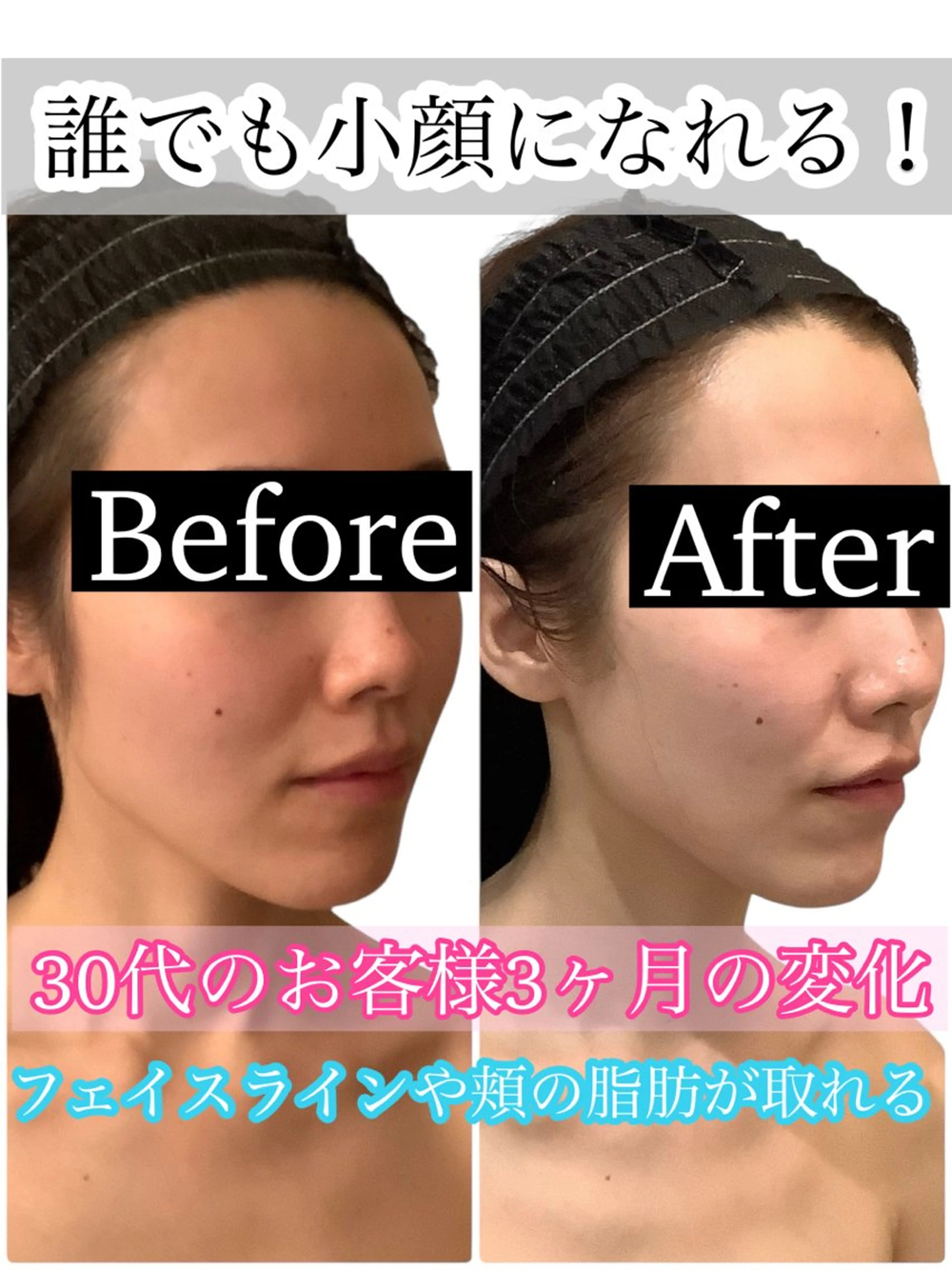 痩身ダイエット&小顔 🩷アールズスリムのエステ・リラクイメージ