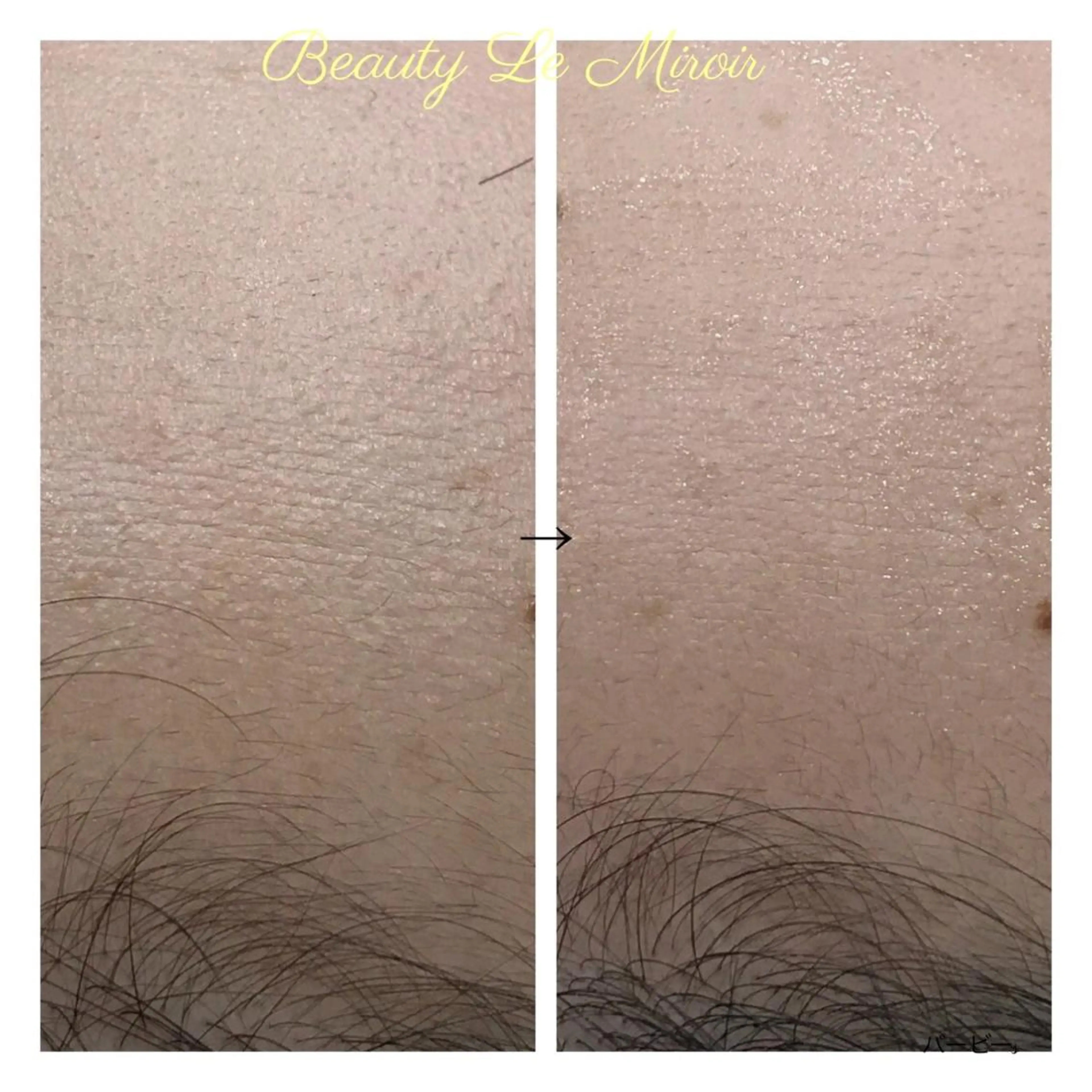 ビューティー ミロワールのエステ・リラクイメージ