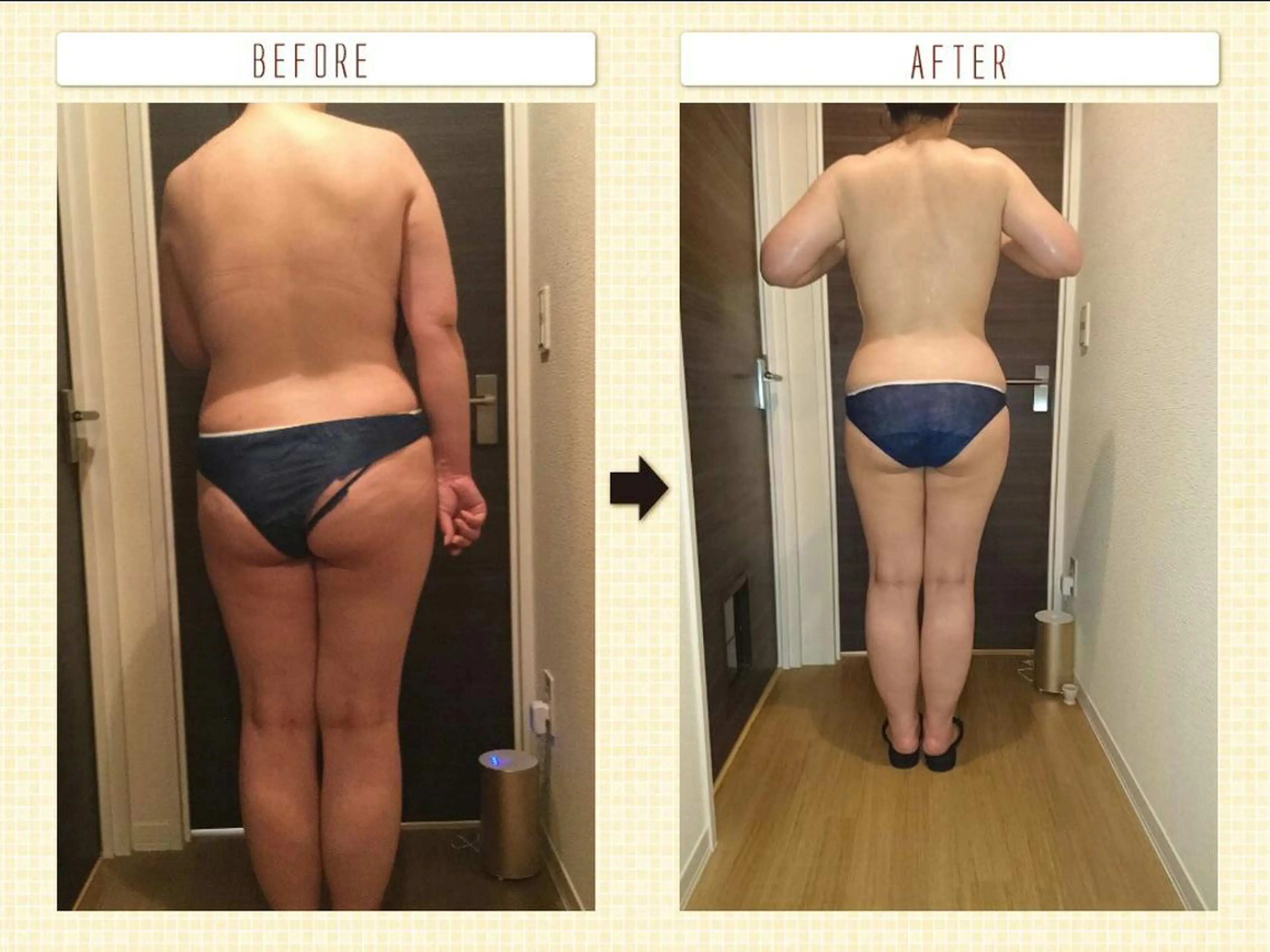 Arebeau 健康的にダイエットのエステ・リラクイメージ