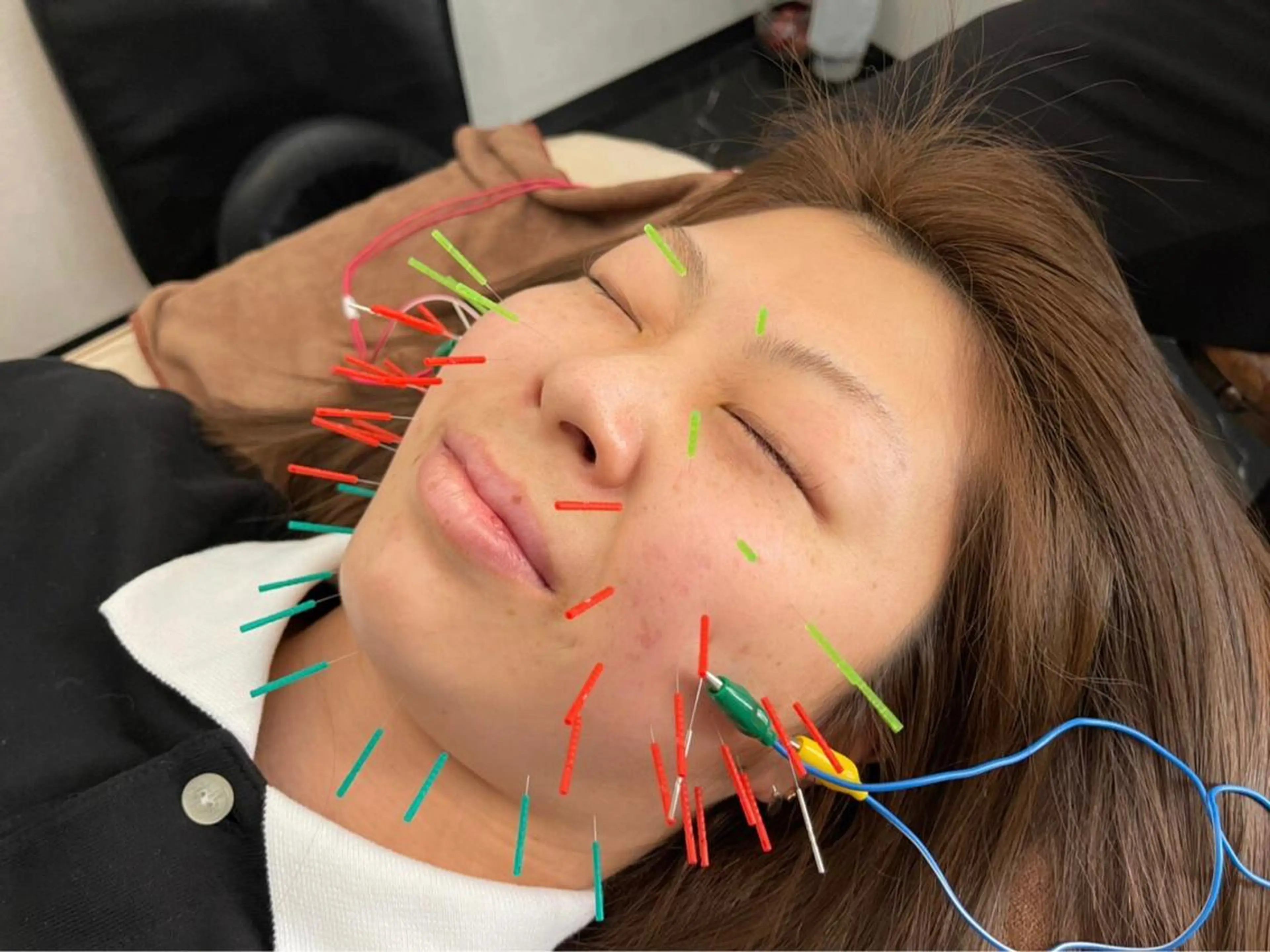 その他 美容鍼灸整体サロンBeauJu所属・小顔矯/美容鍼/鍼灸 BeauJuのその他イメージ