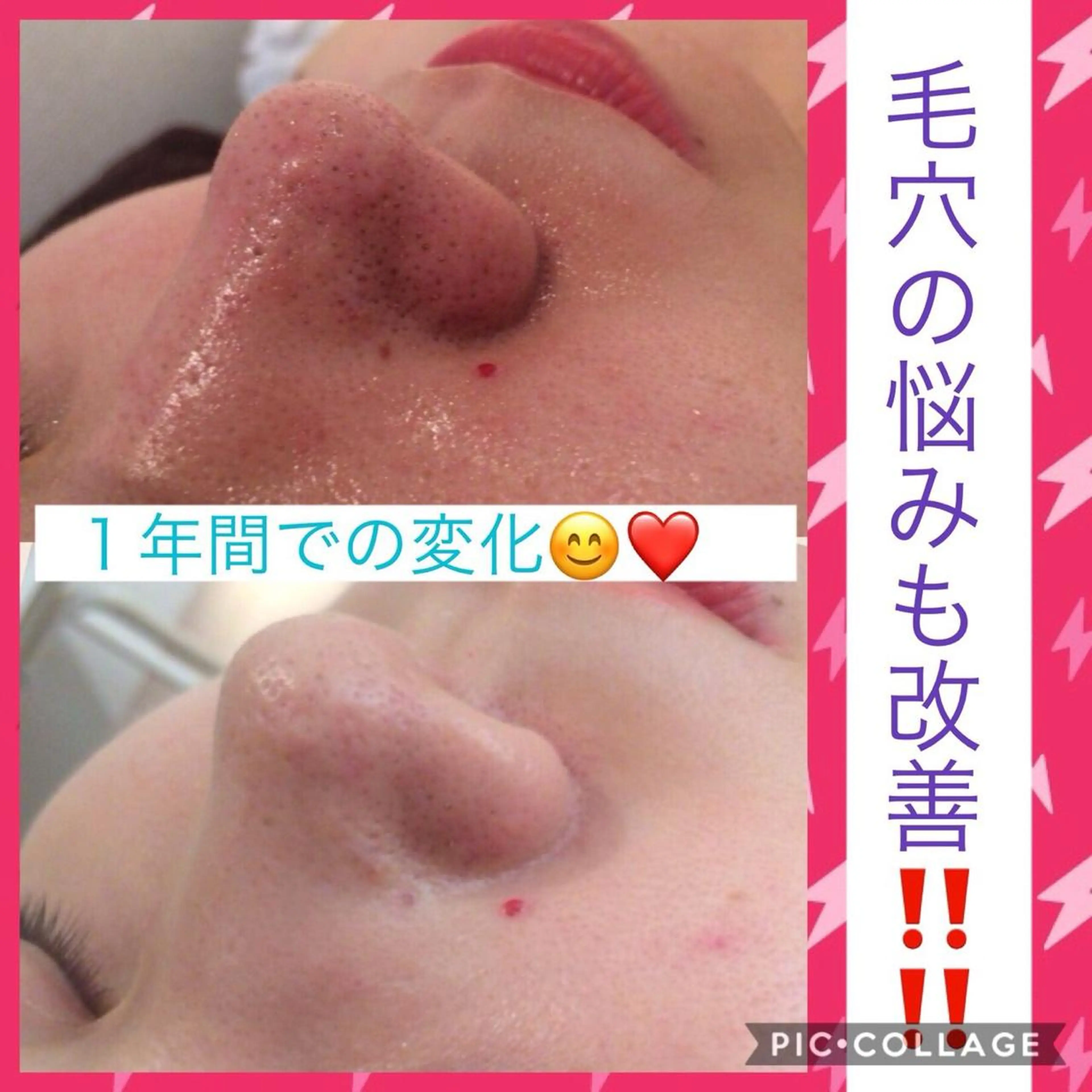 ミディアム パーマ ヘアアレンジ メンズ キッズ ネイル マツエク・マツパ ニキビ・肌質改善専門 ♡人生が変わるサロンのエステ・リラクイメージ