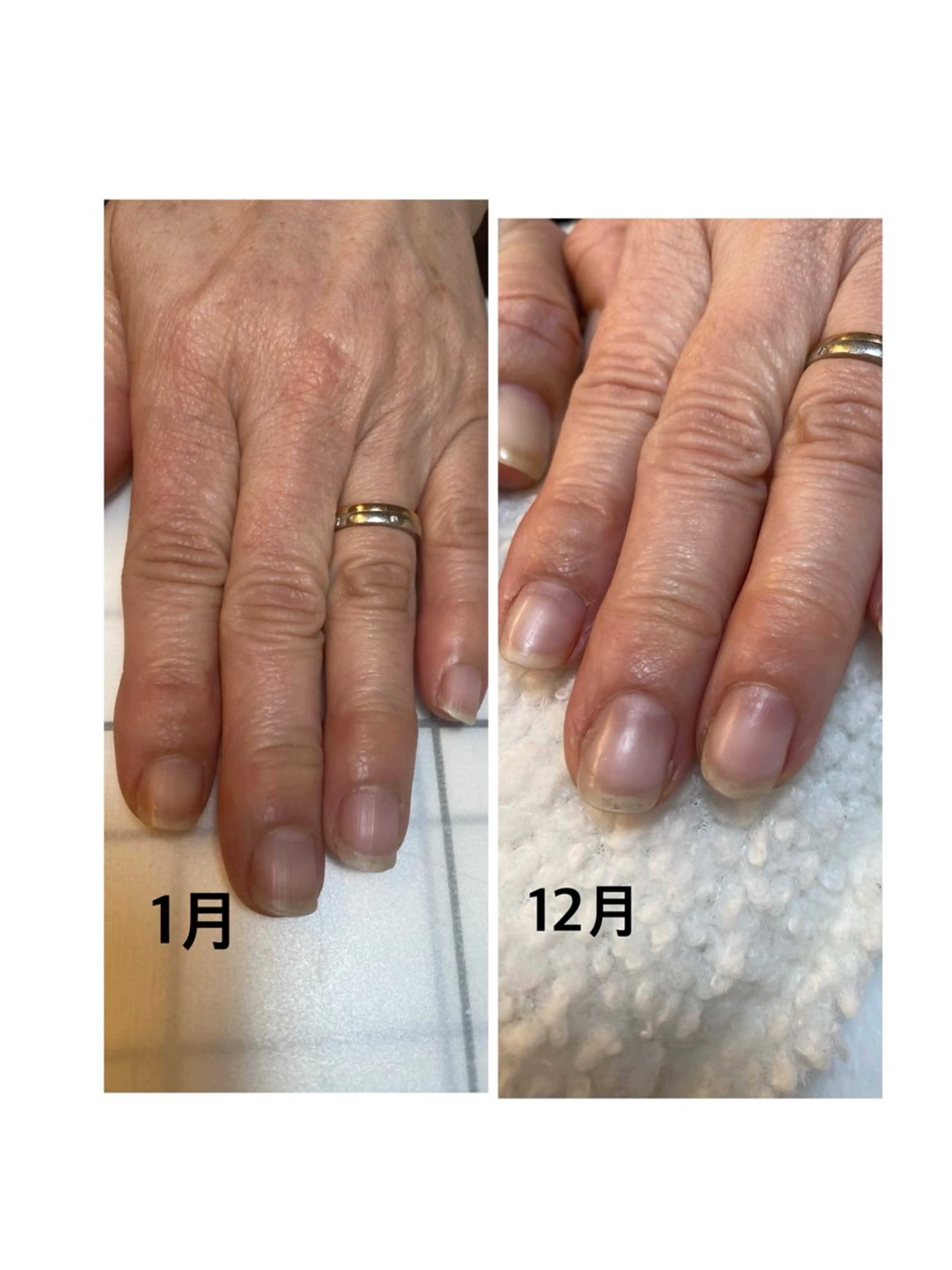 ネイル ハンドネイル Luana所属・浜松市西区舘山寺町 Luana/ひとみのネイルデザイン