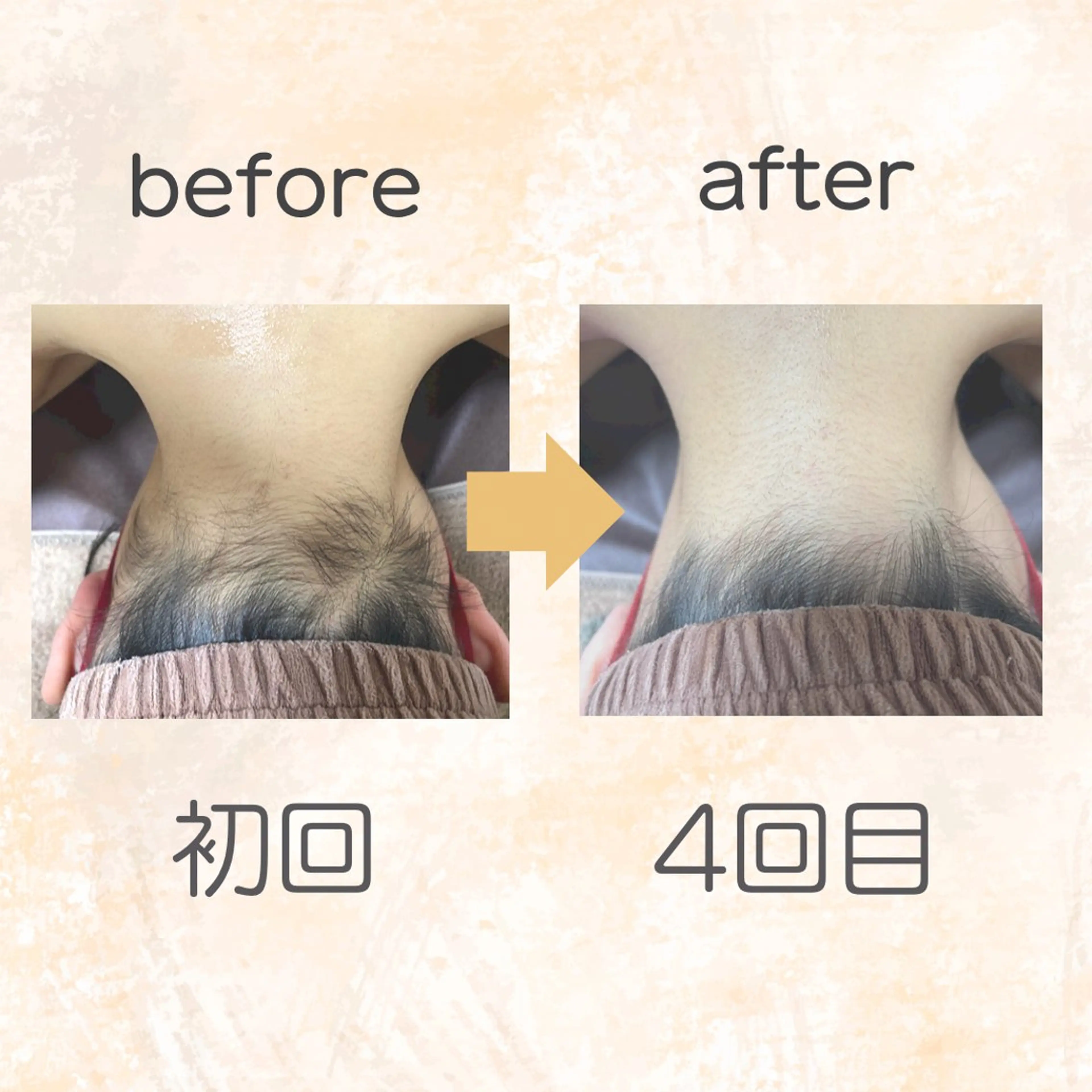 脱毛専門店 Angemのエステ・リラクイメージ