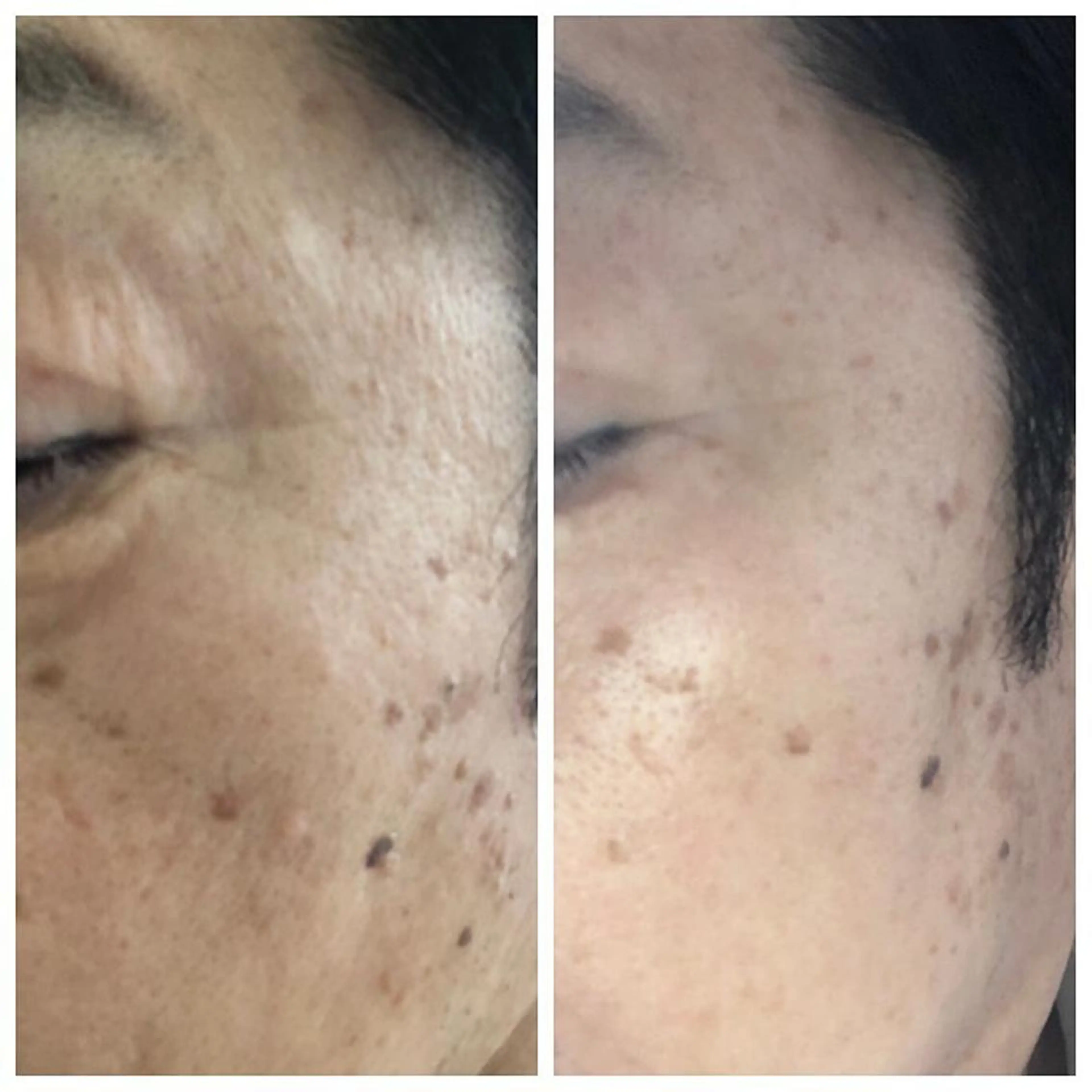 ドリームストリーム アイリストのエステ・リラクイメージ