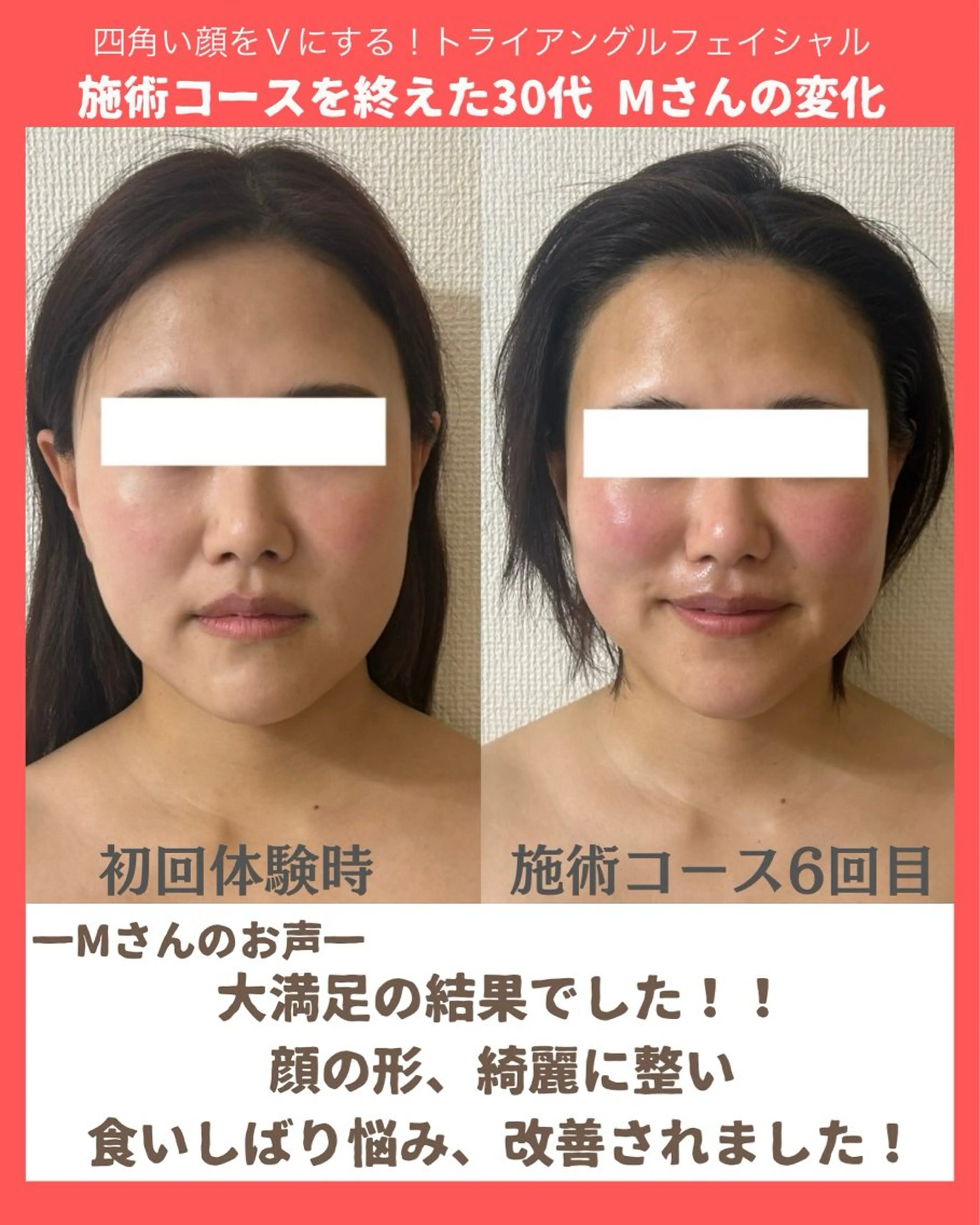 la lumie're (ラ リュミエール)所属・小顔サロン (ラ リュミエール)のエステ・リラクイメージ