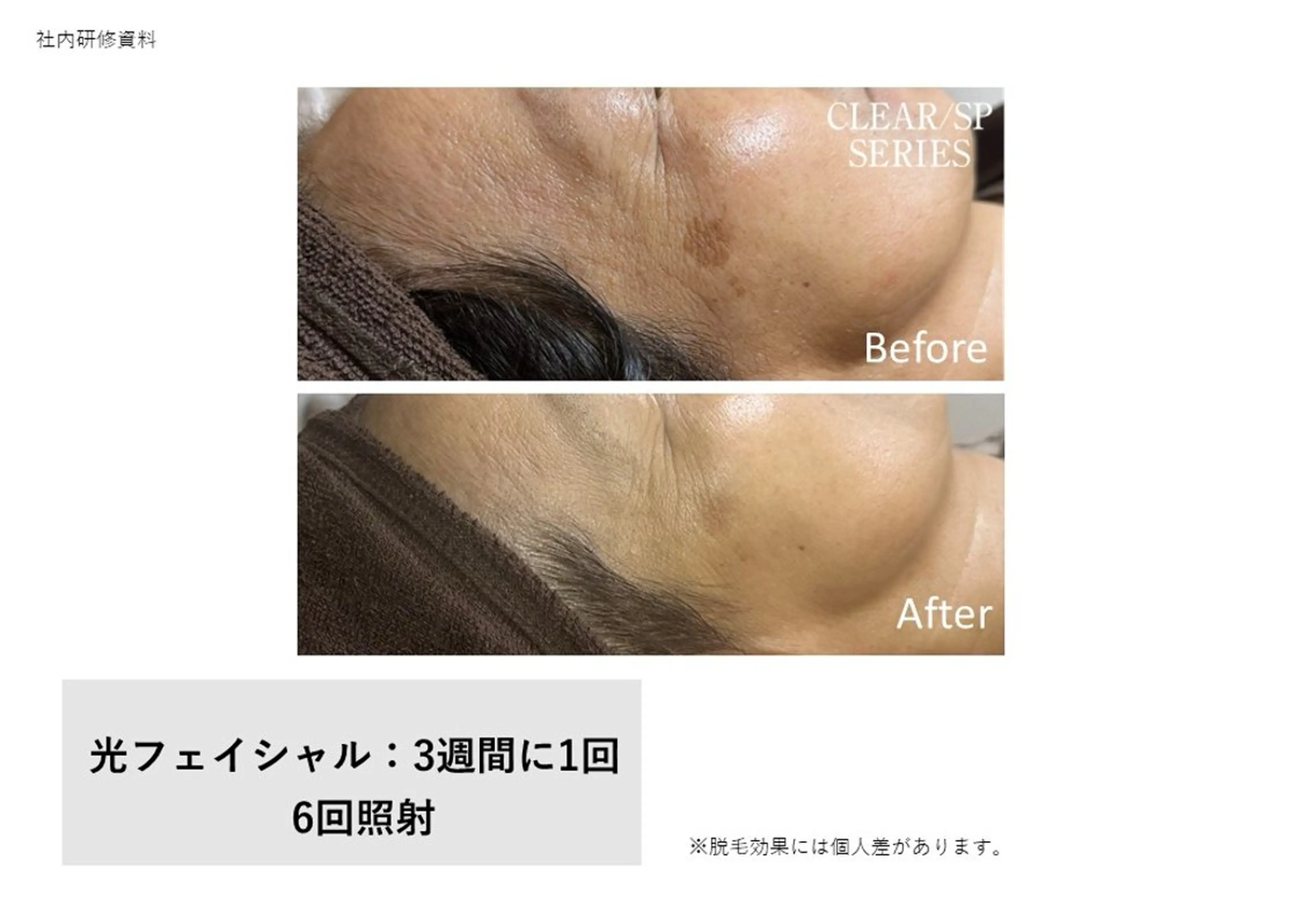 エステ 野口 茂宰のヘアスタイル