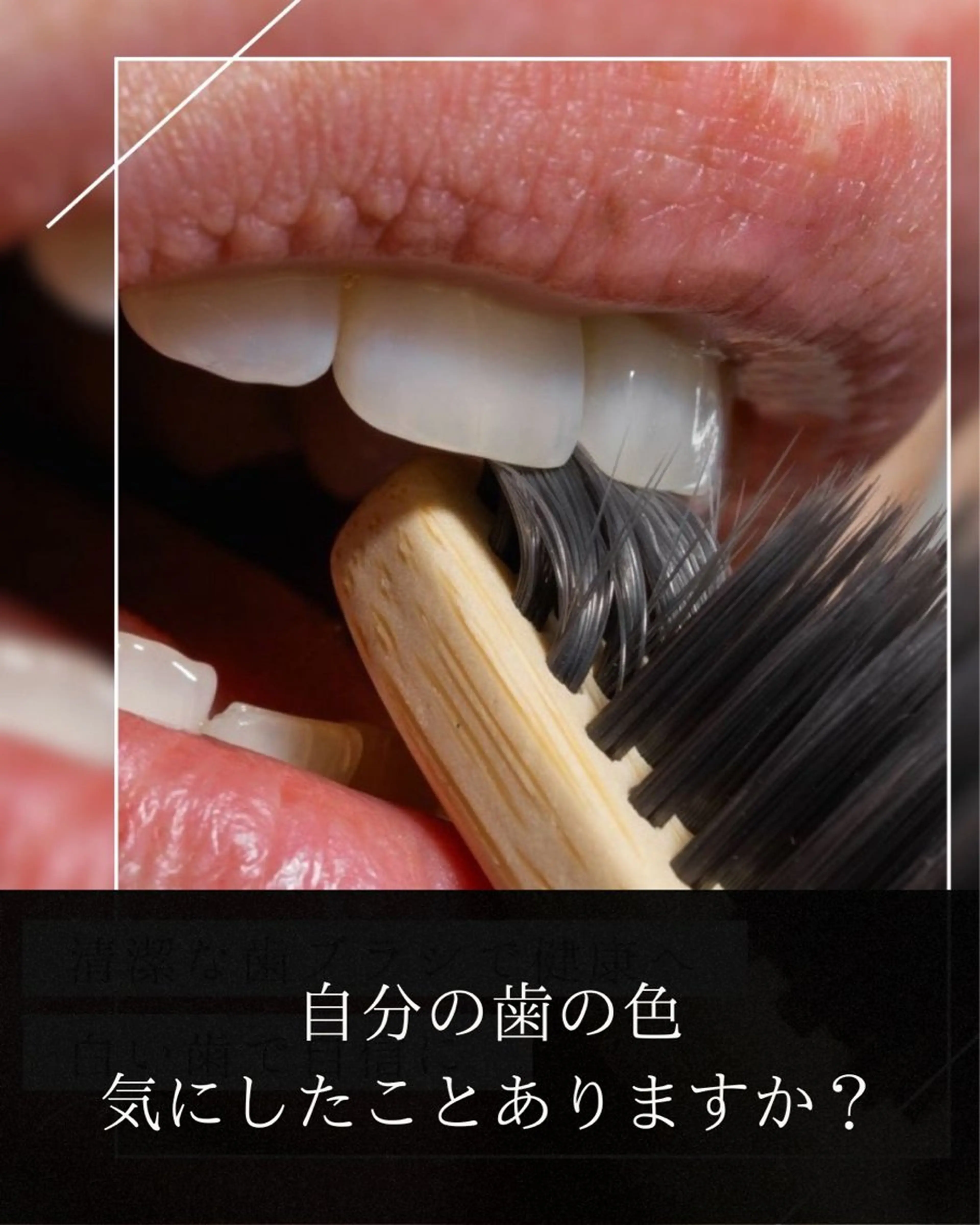 その他 ホワイトニング ショップ津店のその他イメージ