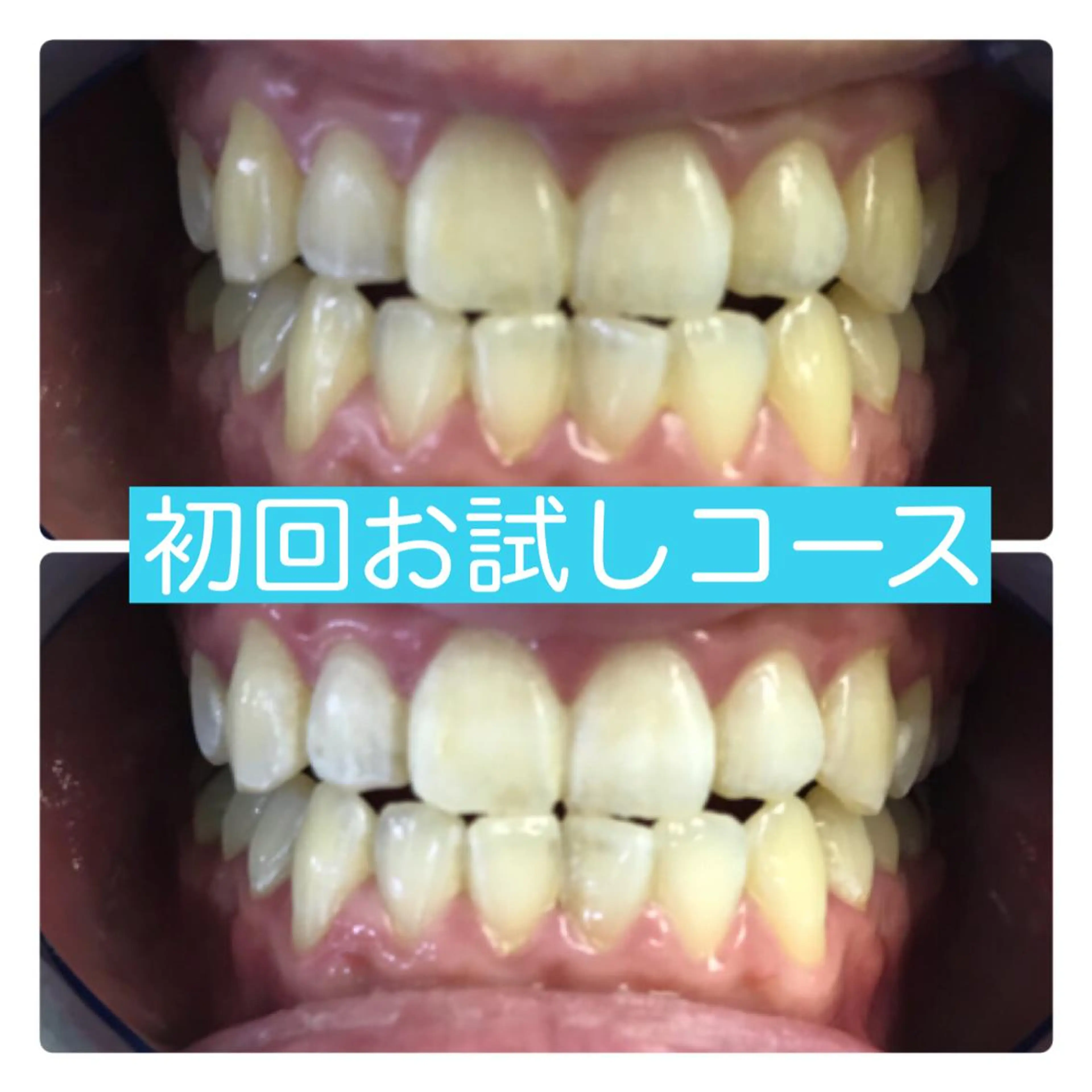 ホワイトニングルーム 横浜店のその他イメージ