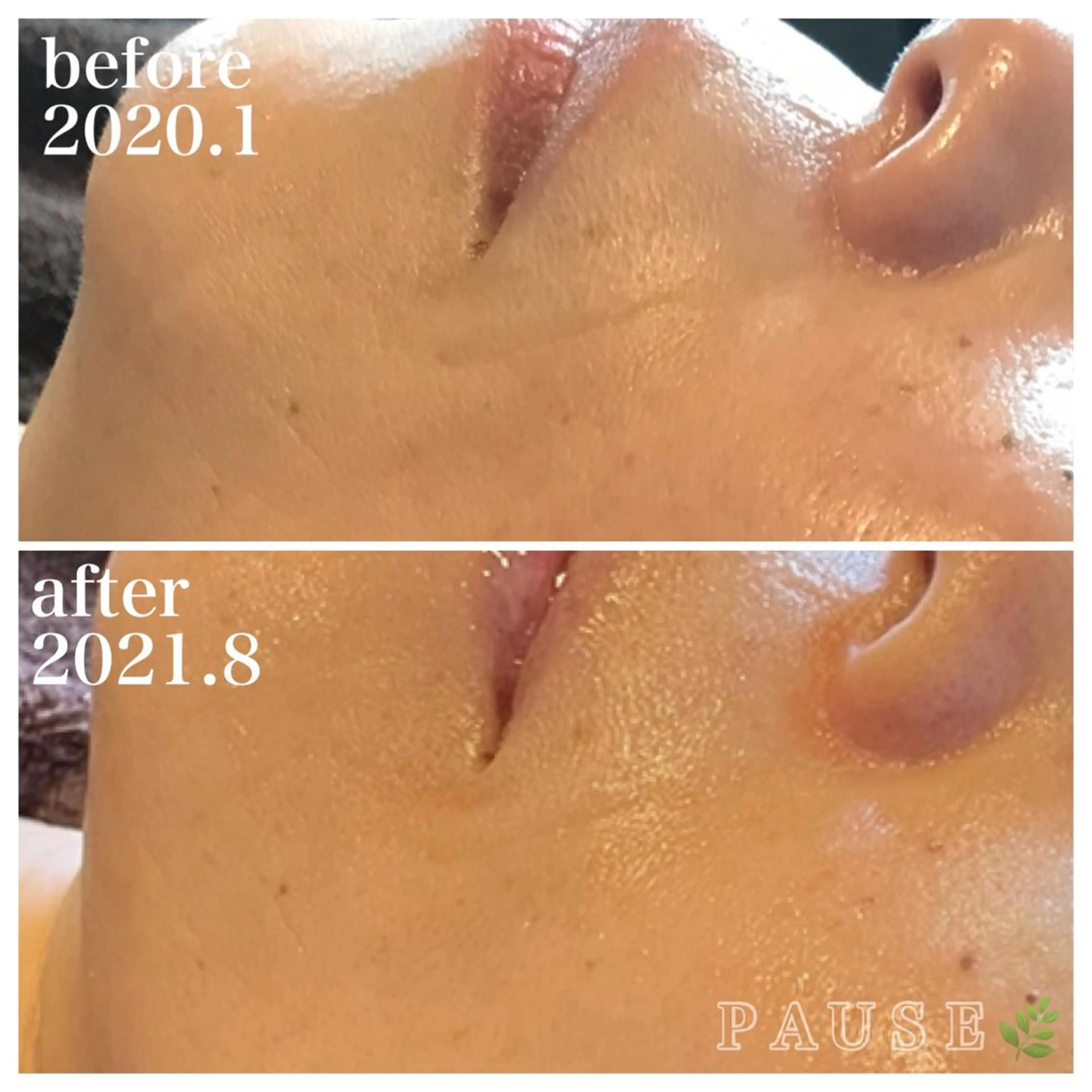 エステ 浜野 恵美のエステ・リラクイメージ