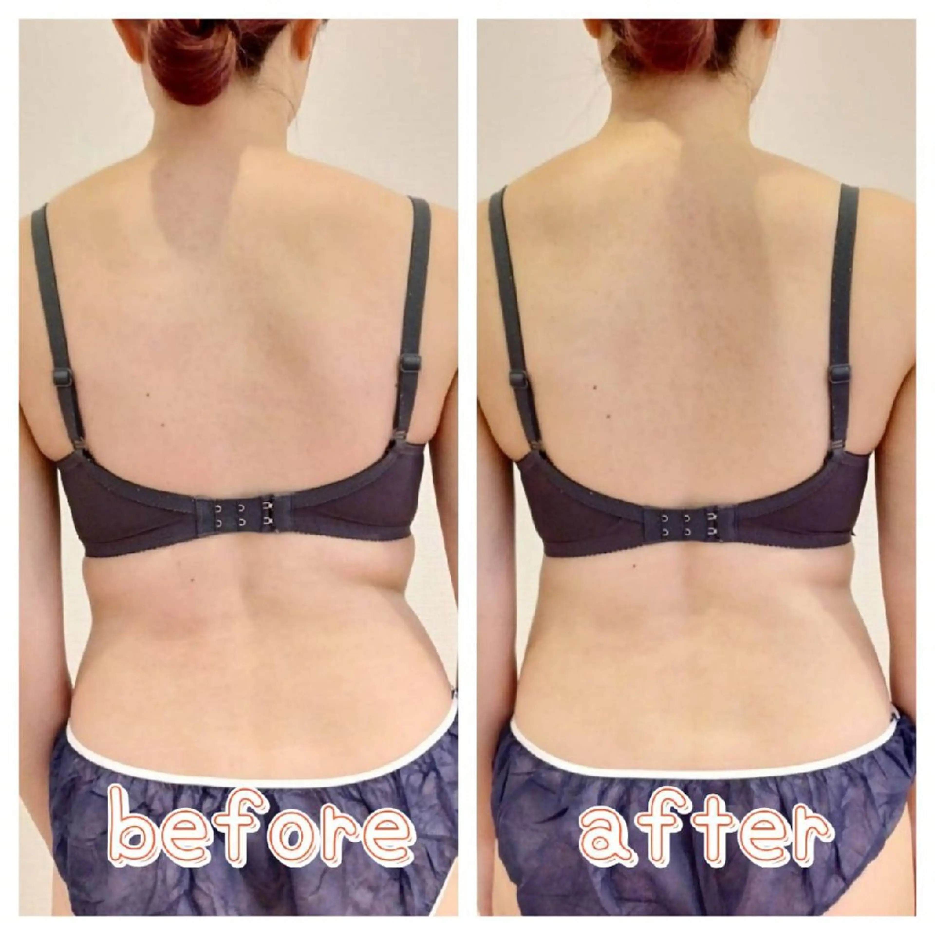 マシュマロバスト coucouのエステ・リラクイメージ