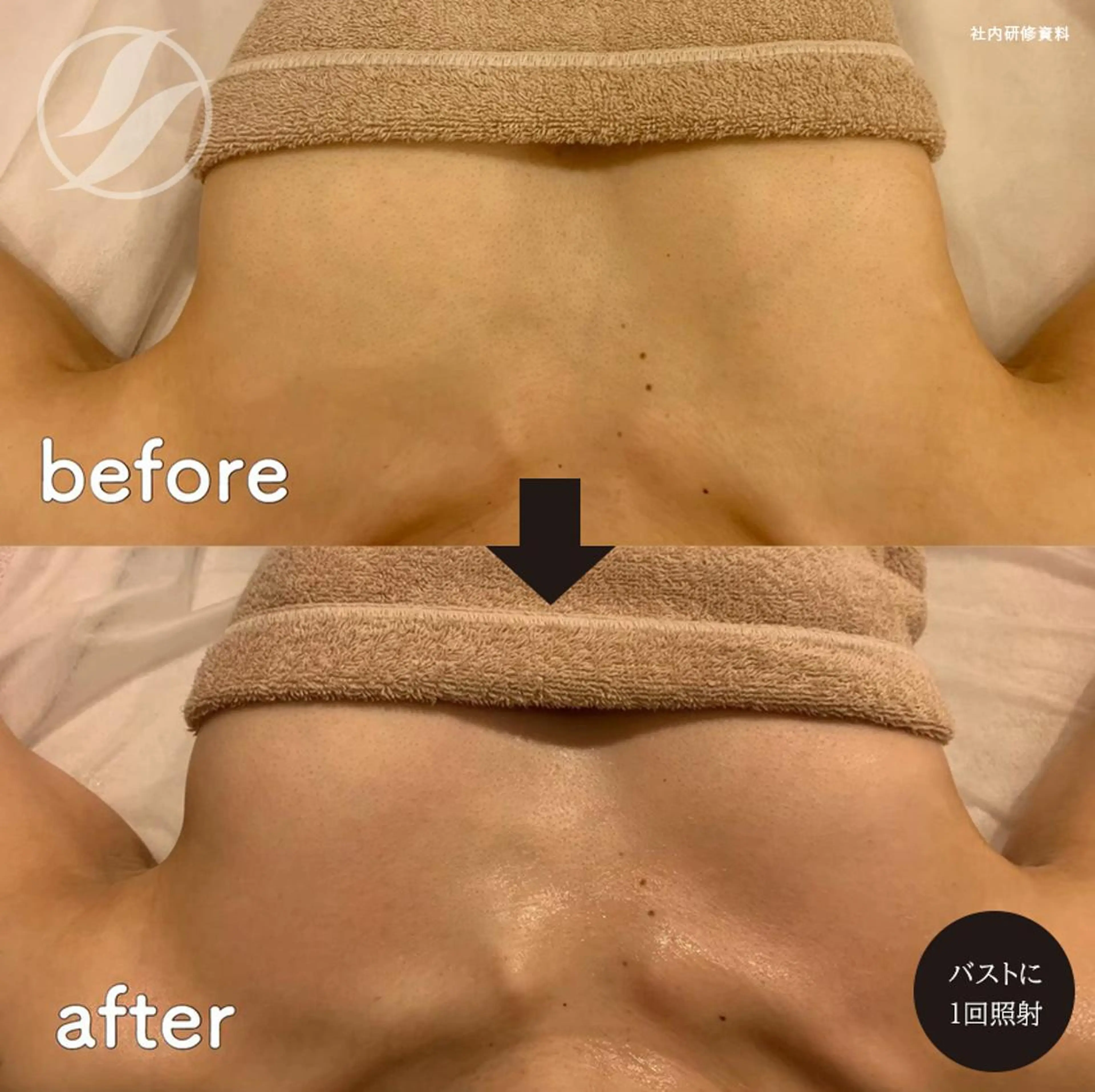 エステ 痩身・脱毛・美髪ケア 【GLYCINE】のエステ・リラクイメージ