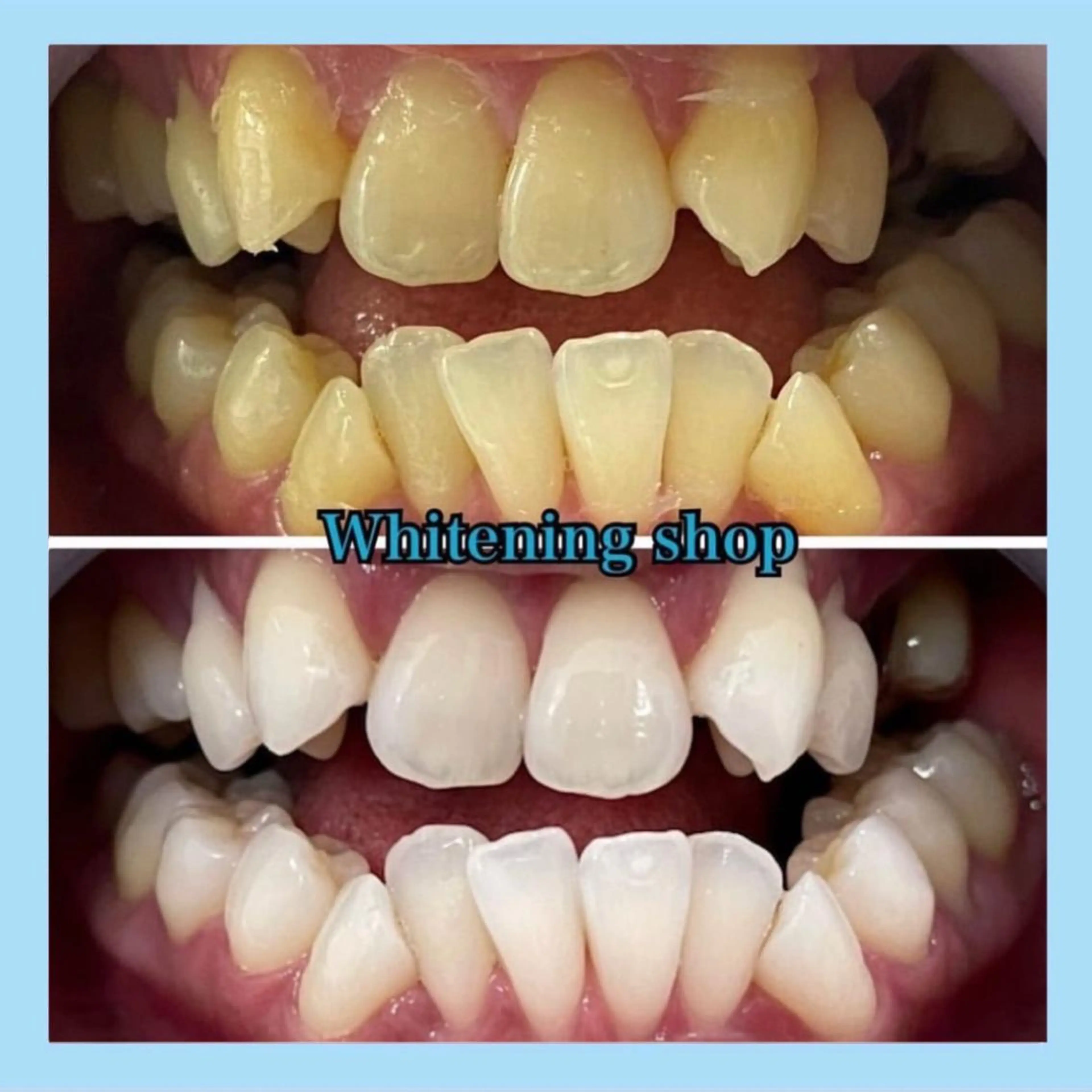 ホワイトニング ショップ千葉店のその他イメージ