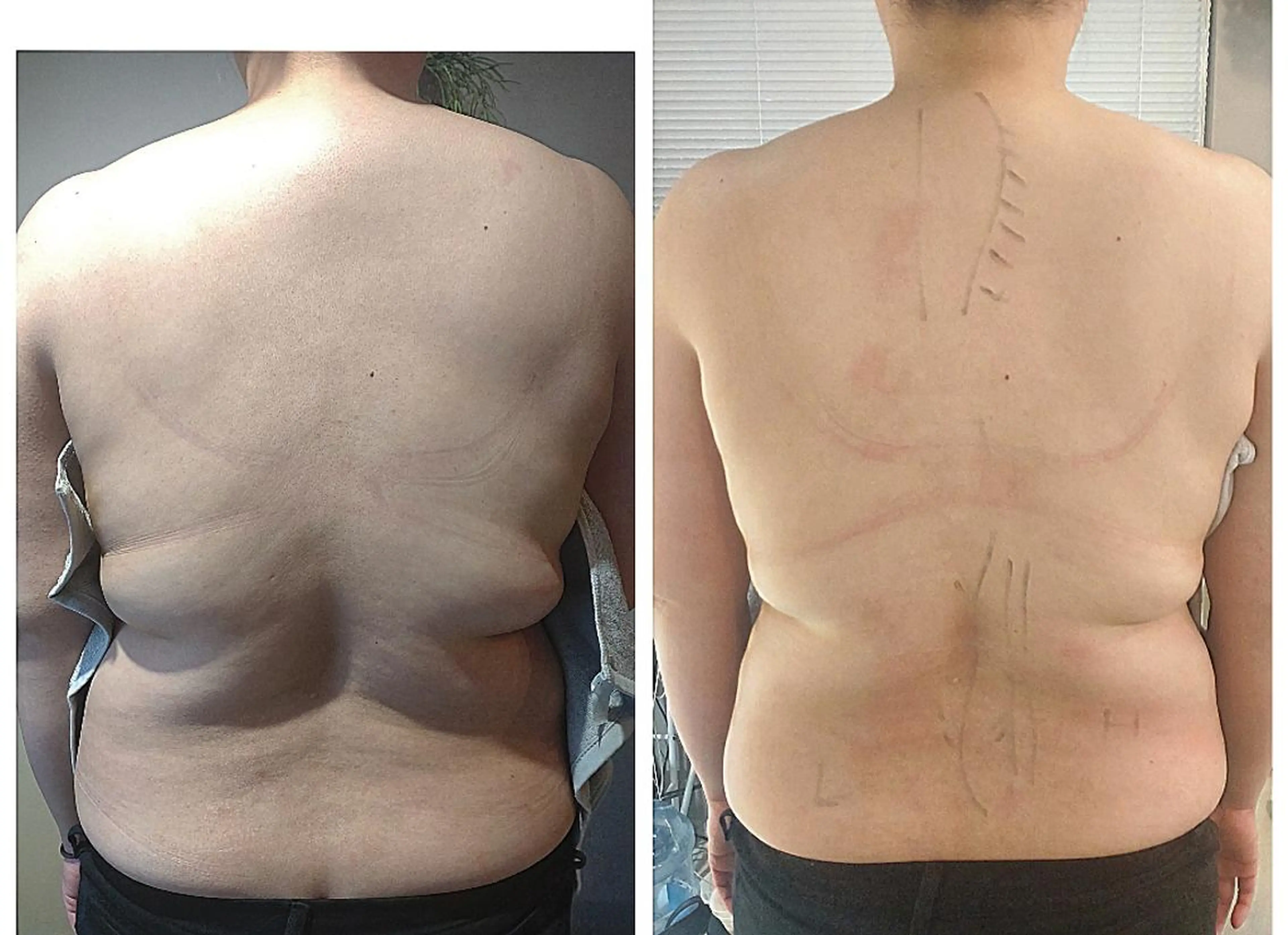 🌹オーダーメイドリンパ120分🌹の写真