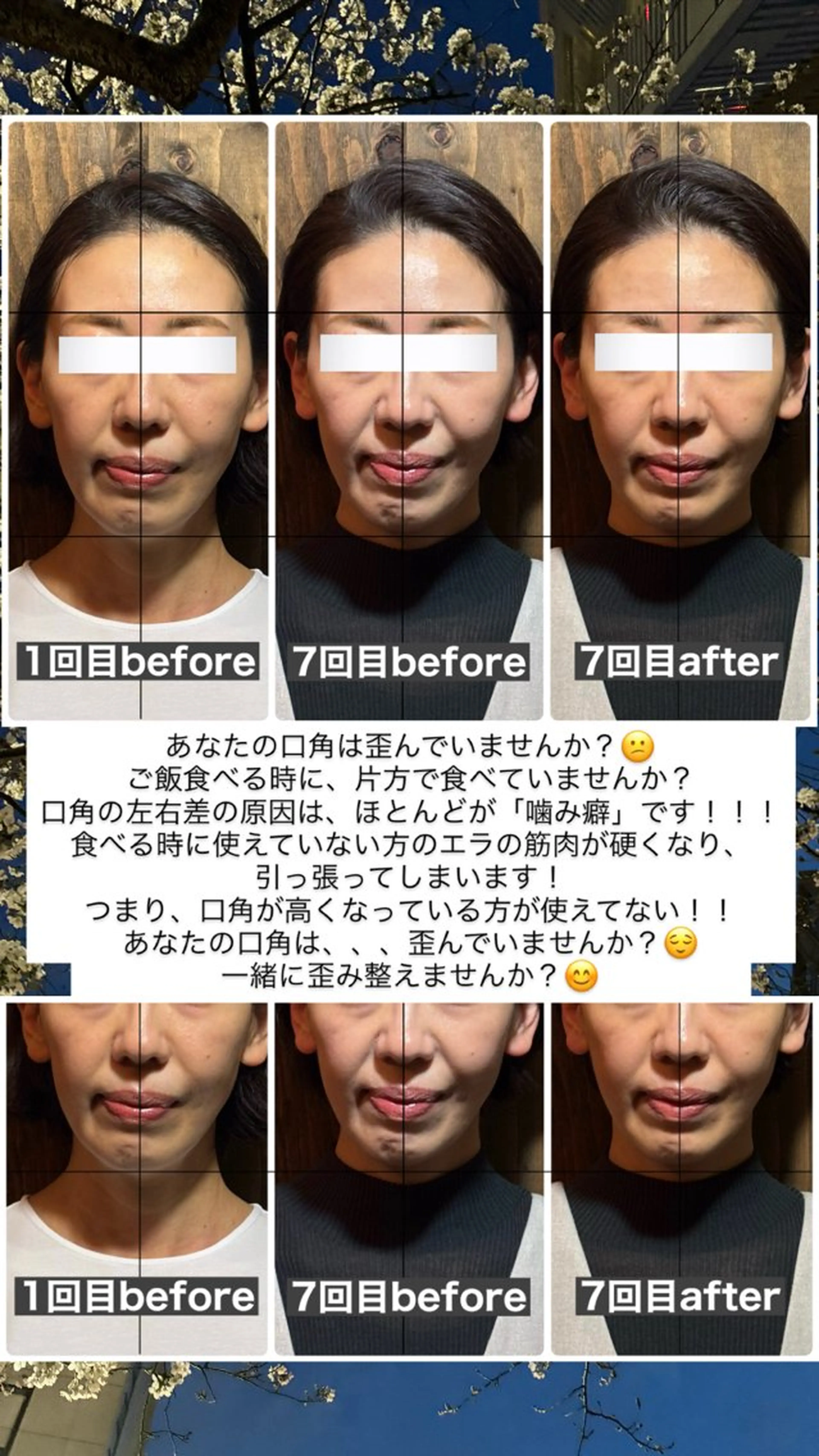 エステ リラク 💎後悔させない小顔 矯正💎イトヤマ🌱のエステ・リラクイメージ