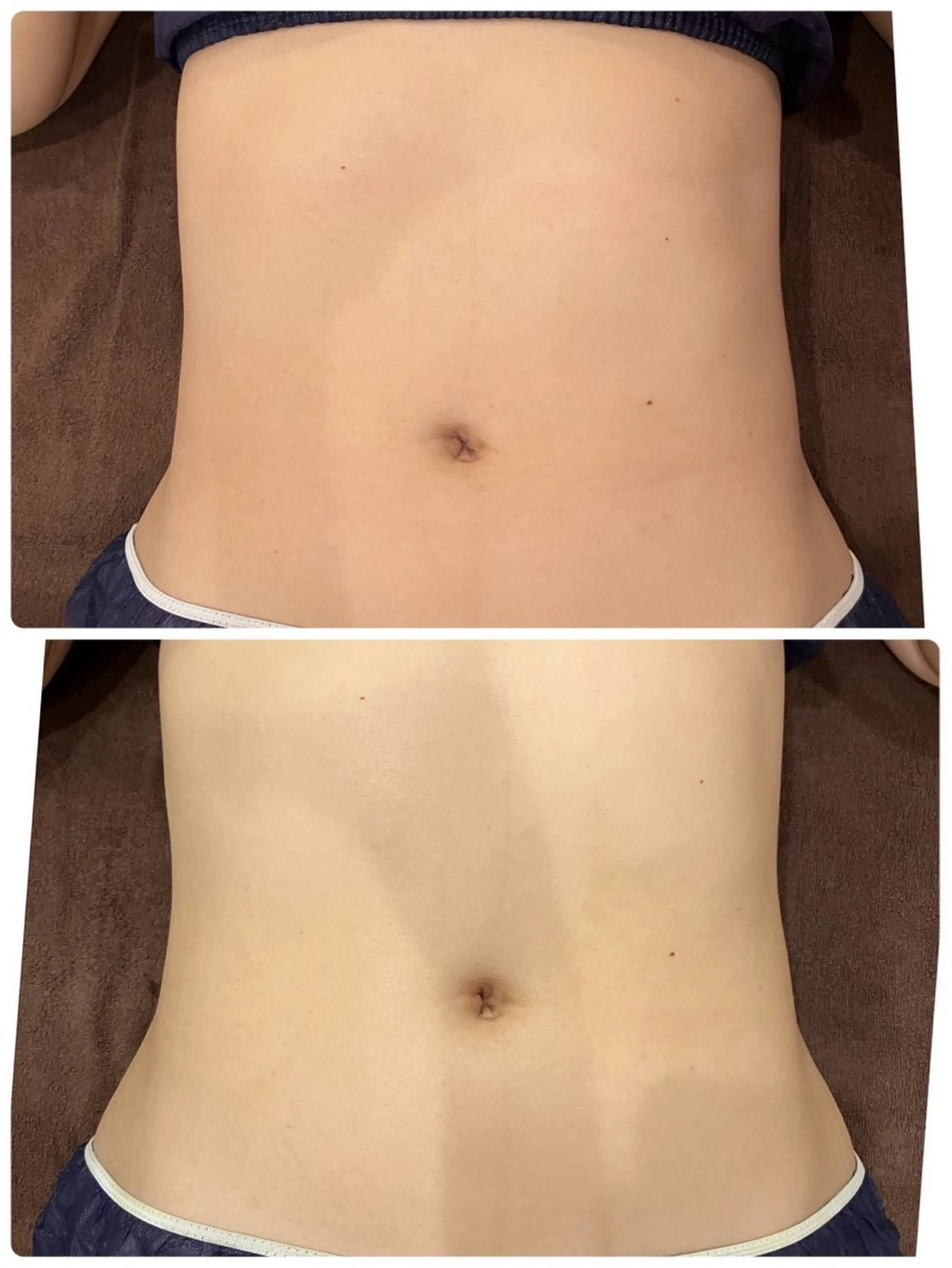 エステ RICHE 【リッシュ】のエステ・リラクイメージ